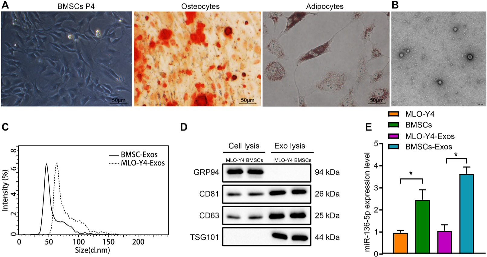 Fig. 2 
            miR-136-5p is highly expressed in bone marrow mesenchymal stem cells (BMSCs) and their exosomes. a) Morphological characteristics of BMSCs at passage 4 and alizarin red S and oil red O staining results of osteogenic as well as adipogenic differentiation observed under an optical microscope (× 200); b) exosome structure diagram observed under a transmission electron microscope after stained by phosphotungstic acid solution (scale bar = 100 nm); c) nanosight particle tracking analysis of the size and number of exosomes; d) Western blot detection of the protein expression of TSG101, CD63, CD81, and GRP94 in MLO-Y4, BMSCs, and their exosomes; e) reverse transcription quantitative polymerase chain reaction (RT-qPCR) detection of the expression of miR-136-5p in MLO-Y4, BMSCs and exosomes; * indicates p < 0.05. Measurement data were presented as mean and standard deviation. Unpaired t-test was used for data comparison between two groups. Data comparisons among multiple groups were performed using one-way analysis of variance (ANOVA) with Tukey’s post hoc test. Data comparison among groups at different timepoints was performed by repeated measures ANOVA with Bonferroni’s post hoc test. The experiment was repeated three times.
          