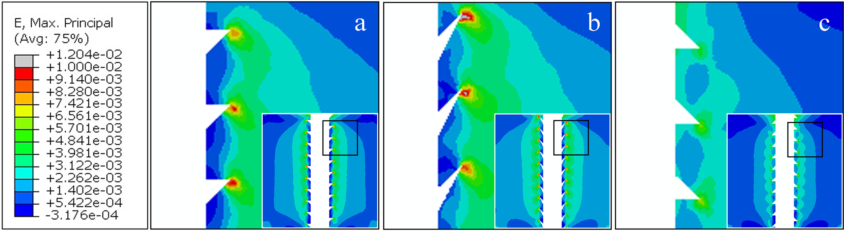 Fig. 4 
            These colour plots show the maximum principal strain contours of the midsagittal plane of the bone samples associated with a) the buttress thread screw, b) the barb thread screw, and c) the reverse buttress thread screw.
          