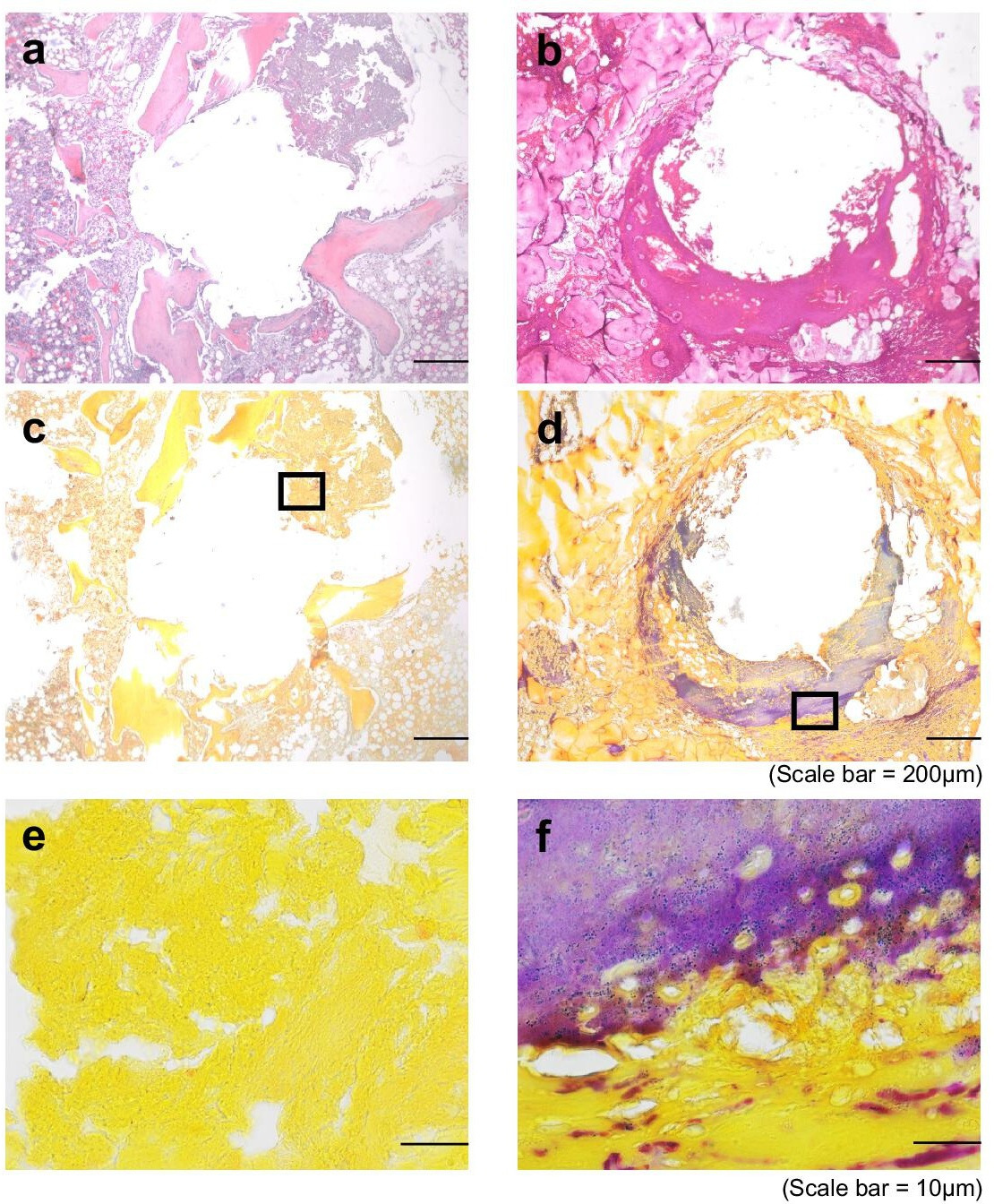 Fig. 5 
            Histological evidence of osteomyelitis. Serial sections from a representative sample in the (a, c, e) control aseptic screw group and (b, d, f) chronic periprosthetic joint infection (PJI) group were stained either with haematoxylin and eosin (H&E) (a, b) and imaged at 40× (scale bar = 200 μm), or with Gram’s stain (c-f) imaged at 40× (c, d; scale bar = 200 μm) or 100× (e,f; scale bar = 10 μm).
          