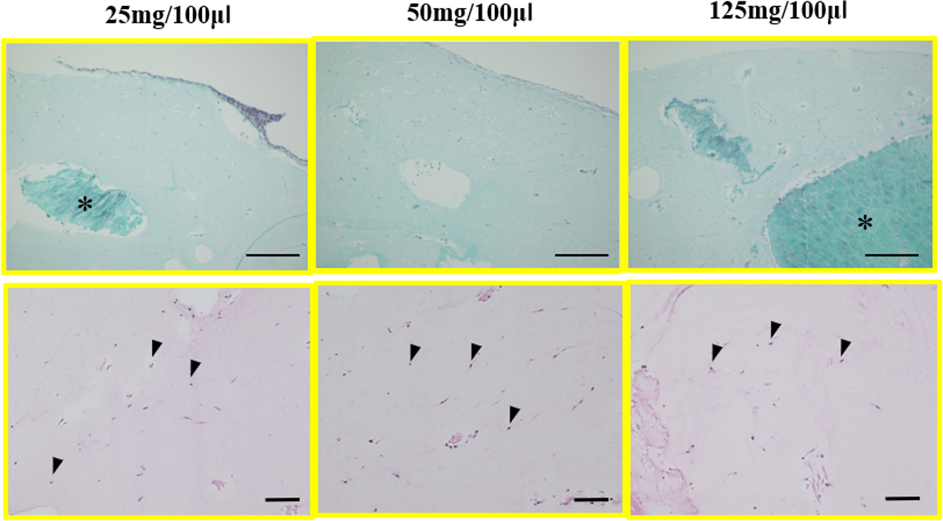 Fig. 1 
          Upper section: Safranin-O/Fast green staining in each group; asterisks denote minced meniscus. Scale = 300 μm. Lower section: haematoxylin and eosin staining in each group. Arrowheads indicate the cells in the atelocollagen gel, scale = 100 μm. The measurements 25 mg, 50 mg, and 125 mg indicate the volume of minced meniscus embedded in 100 µl of atelocollagen.
        