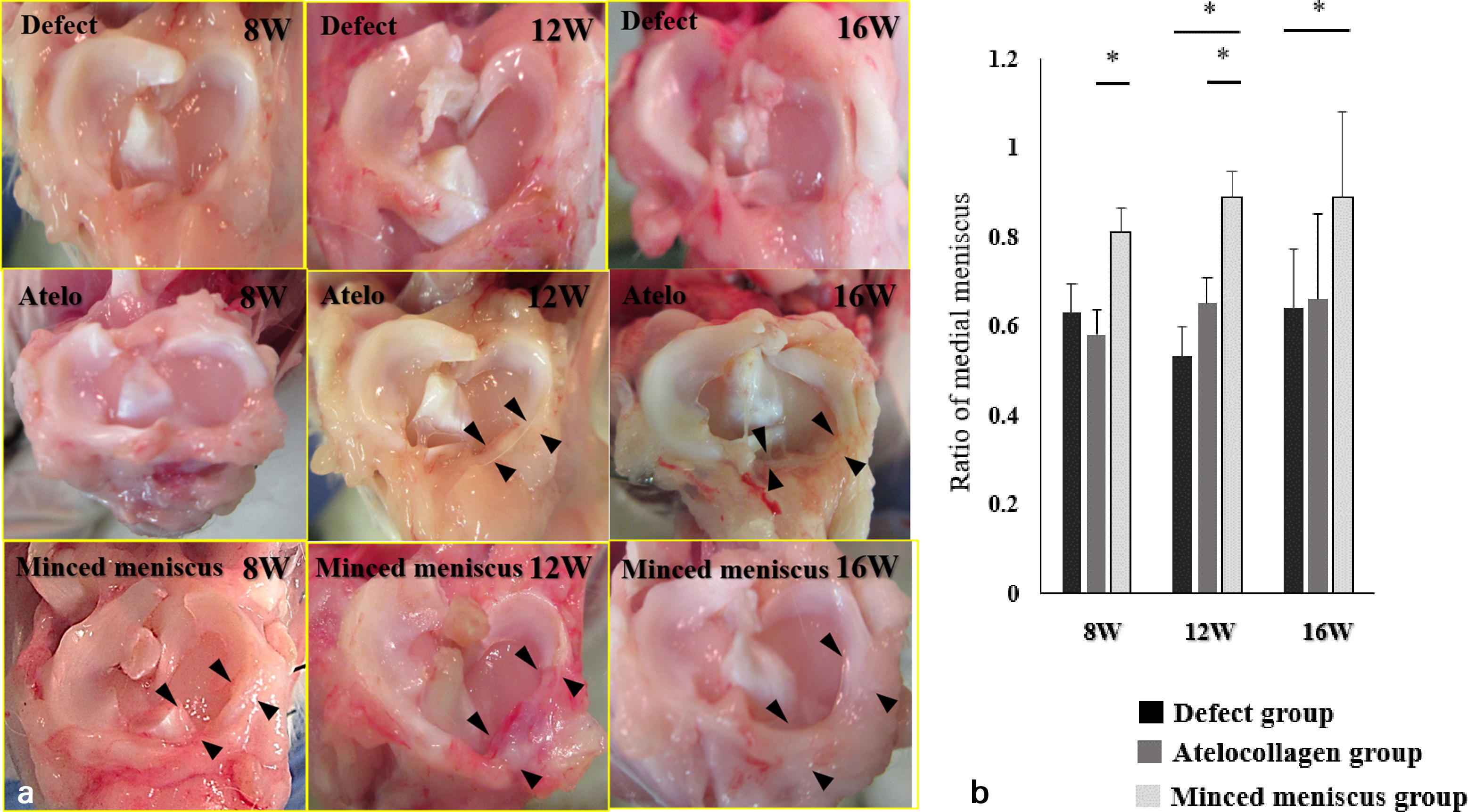 Fig. 3 
          a) Upper sections (defect groups). The scar tissue can be seen at eight weeks, although the tissues are incomplete. Middle sections represent the atelocollagen groups. Steady but thin tissues can be seen at 12 weeks. Lower sections represent minced meniscus groups. Steady and complete tissues can be seen at 16 weeks. Arrowheads indicate regenerated tissues. b) The percentage of the regenerated medial meniscus for both groups was defined as that of the area of the regenerated medial meniscus to the lateral meniscus. The percentages of medial minced meniscus are better in the minced meniscus groups than in the other groups (p = 0.011, p = 0.036, p = 0.043, and p = 0.026, respectively). *p < 0.05.
        