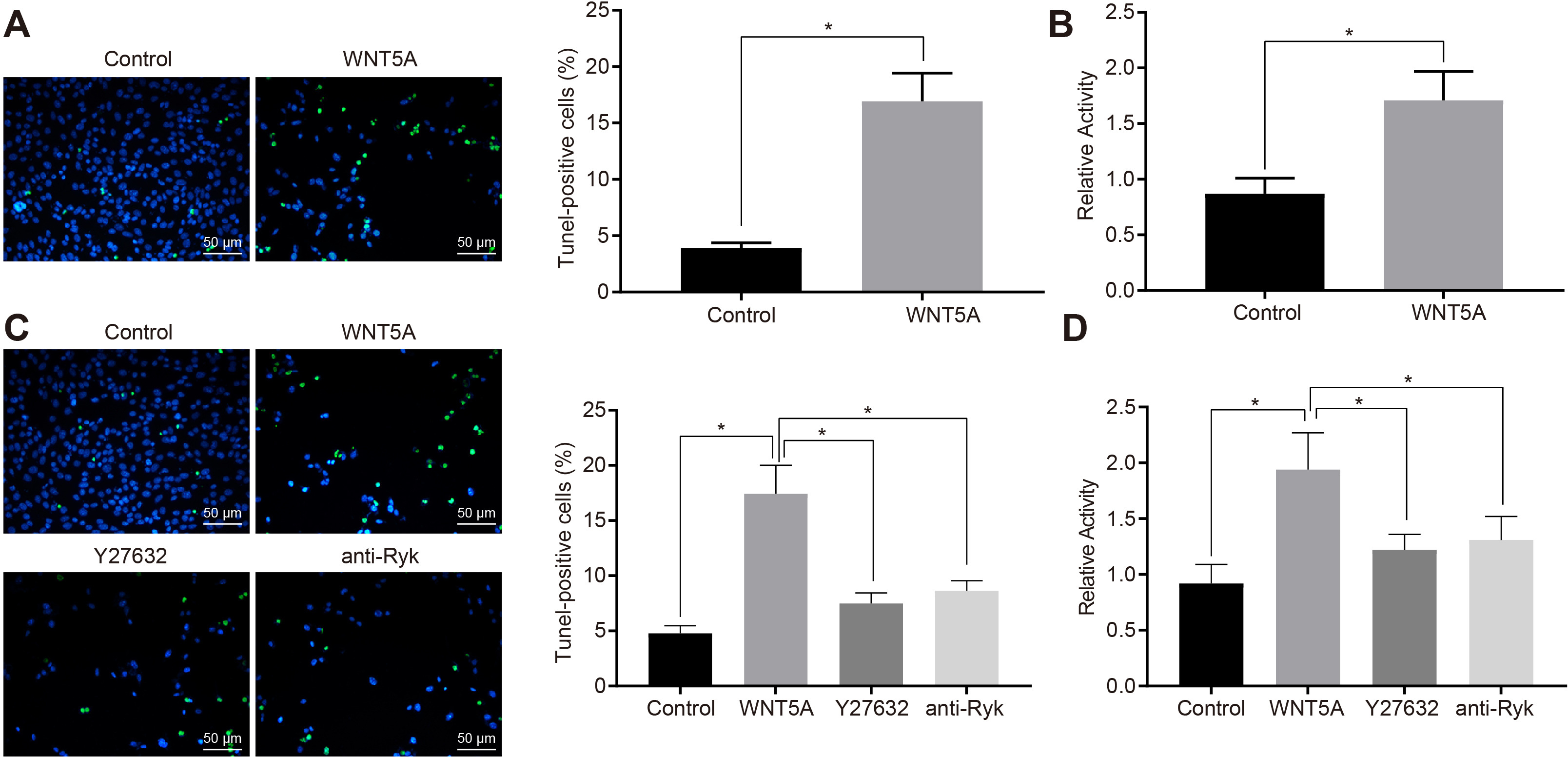 Fig. 4 
            Wnt family member 5A (WNT5A) promoted the apoptosis of neurons in dorsal root ganglia (DRG) cells by activating RhoA/Rho-kinase activity. a) DRG cells were treated with 90 ng/ml or without WNT5A for 24 hours. The apoptosis of DRG cells was detected by terminal deoxynucleotidyl transferase dUTP nick end labeling (TUNEL) assay (magnification 200×). b) DRG cells were treated with or without 90 ng/ml WNT5A for ten minutes and Rho kinase activity was detected by G-LISA Rho activity assay. c) DRG cells without any treatment and DRG cells treated with WNT5A, WNT5A + Y27632 (10 uM; inhibited the activity of Rho-kinase), and WNT5A + anti Ryk antibody (0.5 ug/ml) for 24 hours were tested by TUNEL staining (magnification 200×). d) DRG cells without any treatment and DRG cells treated with WNT5A, WNT5A + Y27632 (10 μM) (inhibited the activity of Rho-kinase), or WNT5A + anti Ryk antibody (0.5 ug/ml) for ten minutes were detected by G-LISA Rho activity assay. *p < 0.05 versus the control. Measurement data were expressed as means and SDs. The independent-samples t-test was used to compare the data between two groups. Data comparison among multiple groups was analyzed by one-way analysis of variance (ANOVA), followed by Tukey’s post hoc test. Results are derived from three separate experiments.
          