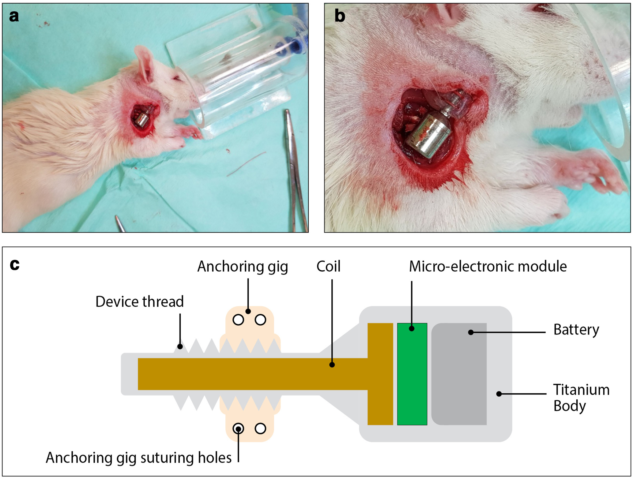 Fig. 1 
            a) and b) Miniaturized electromagnetic device (MED) implantation procedure in the subcutaneous space on the right shoulder. c) Schematic presentation of the MED-pulsed electromagnetic field (PEMF) generating device. The device is shaped like a dental healing abutment and made of a titanium body that houses a microelectronics module, micro battery, and coil.
          