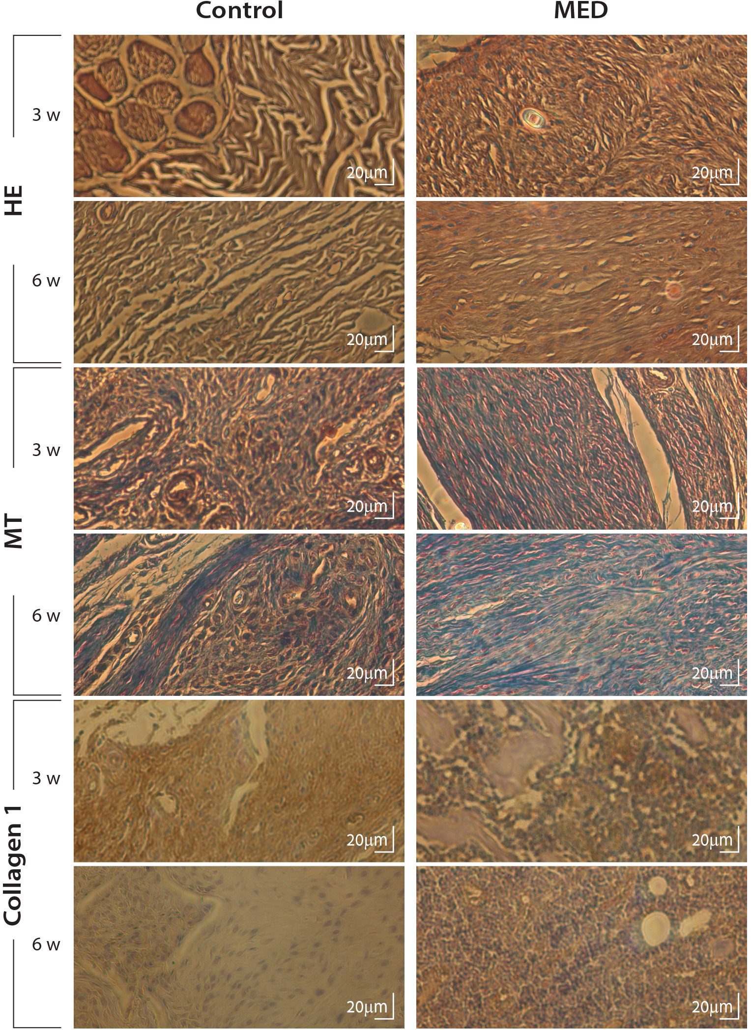 Fig. 5 
            Representative images of histological and immunohistochemical analyses. Miniaturized electromagnetic device (MED) and control groups were evaluated at three and six weeks. Tendon immunohistochemistry revealed a prominent increase in type I collagen at the repair site at three weeks following continuous pulsed electromagnetic field (PEMF) treatment compared with controls, but these differences were less notable after six weeks. HE, haematoxylin and eosin; MT, Masson’s trichrome.
          