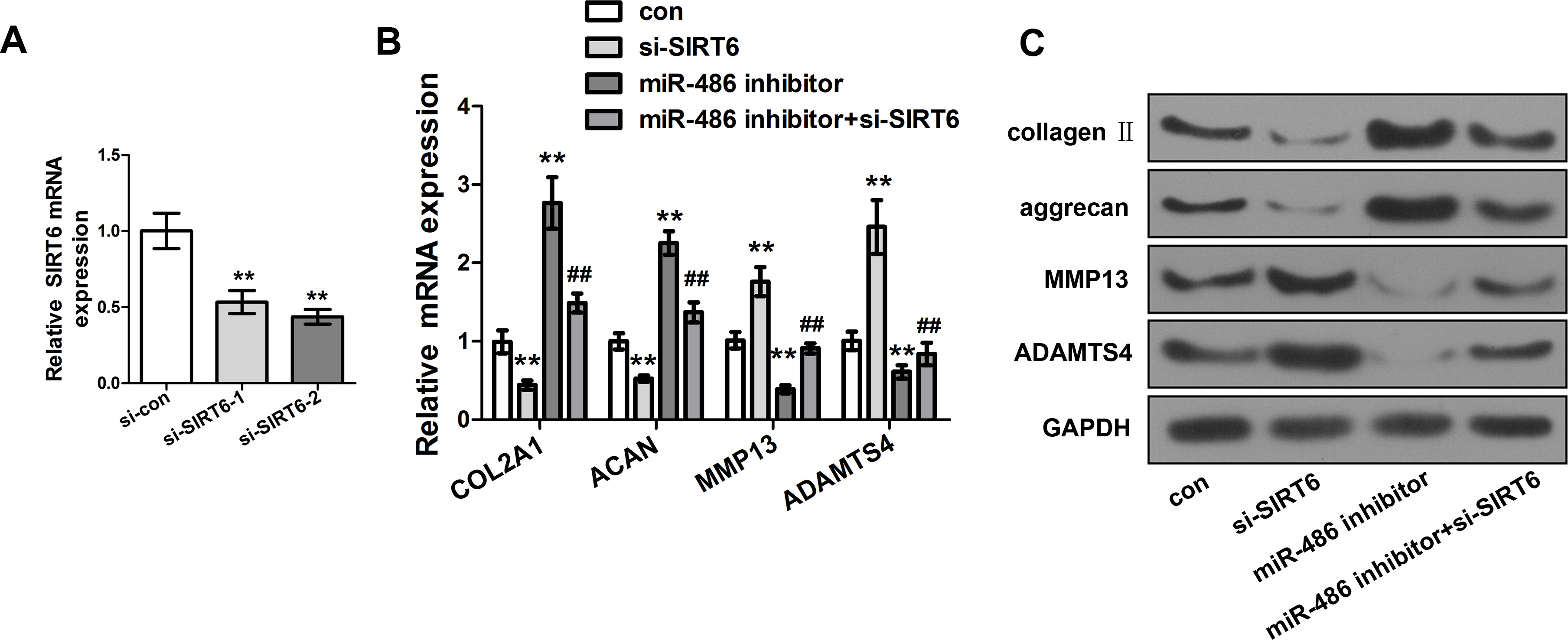 Fig. 4 
            Silencing information regulator 6 (SIRT6) as a target for microRNA 486 (miR-486)-induced chondrocyte extracellular matrix (ECM) metabolism. a) Detection of the messenger RNA (mRNA) expression level of SIRT6 in small interfering RNA-control (si-con) or si-SIRT6 transfected SW1353 cells by quantitative real-time polymerase chain reaction (qRT-PCR). b) Detection of the mRNA expression levels of collagen, type II, alpha 1 (COL2A1), aggrecan (ACAN), matrix metalloproteinase (MMP)-13, and ACANase 4 (ADAMTS4) in miR-486 inhibitor or si-SIRT6 co-transfected SW1353 cells by qRT-PCR. c) Detection of the protein expression levels of COL2A1, aggrecan, MMP-13, and ADAMTS4 in miR-486 inhibitor or si-SIRT6 co-transfected SW1353 cells by western blot. Compared to the control group, **p < 0.001; compared to the miR-486 inhibitor group, ##p < 0.001. All statistical analyses were conducted with independent-samples t-test.
          