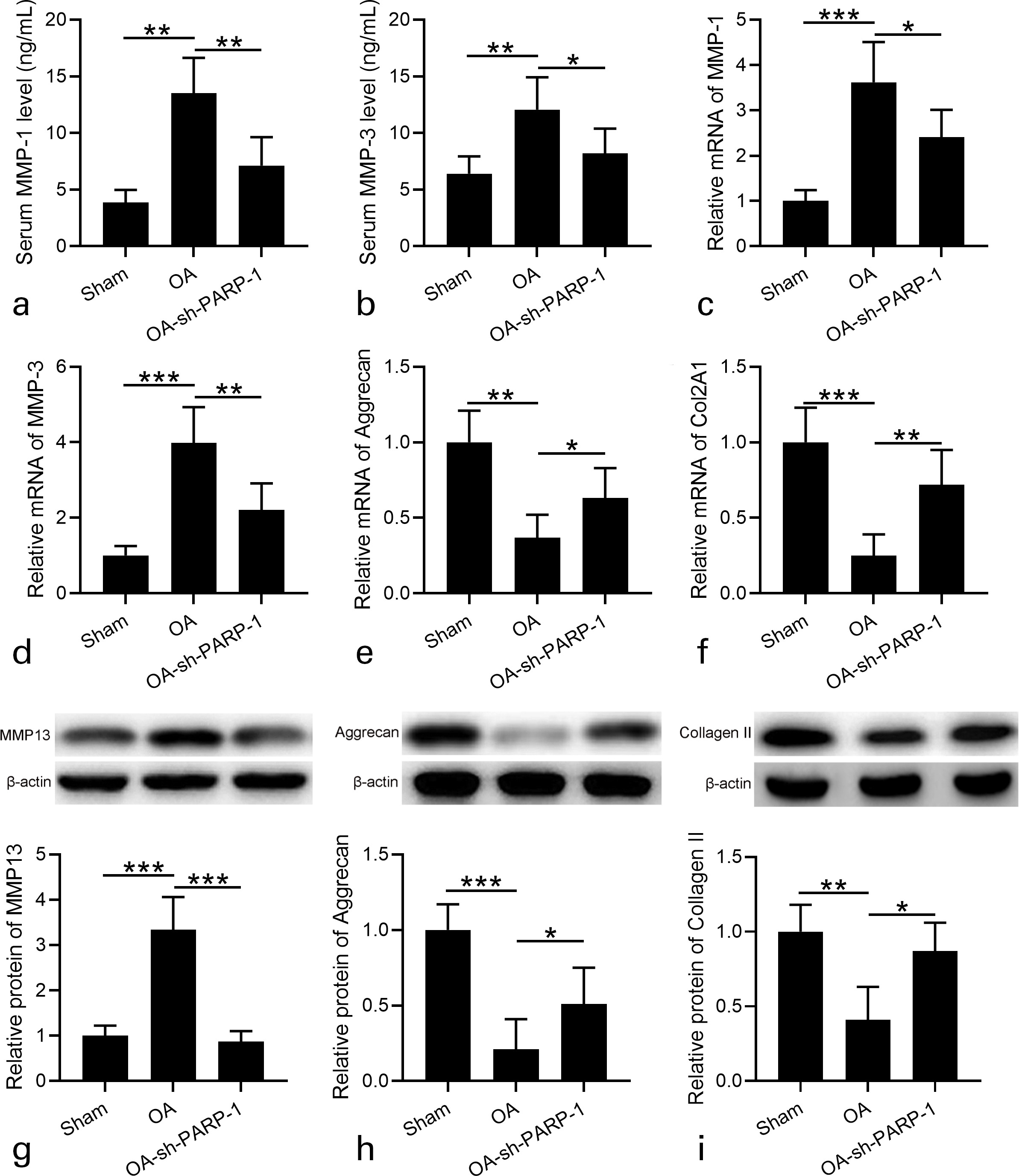 Fig. 4 
            Effects of intra-articular injection of poly (ADP-ribose) polymerase 1 (PARP-1) shRNA (short hairpin (sh)-PARP-1) on the expression of cartilage matrix catabolic enzymes in the cartilage and ameliorated osteoarthritis (OA) cartilage degradation in rats 12 weeks after anterior cruciate ligament transection (ACLT) plus medial meniscus removal (MMx). a) and b) Serum matrix metalloproteinase (MMP)-1 and MMP-3 were measured by enzyme-linked immunosorbent assay (ELISA). c) and d) Real-time quantitative reverse transcription polymerase chain reaction (RT-qPCR) was used to analyze the messenger RNA (mRNA) expression levels of MMP-1 and MMP-3 in cartilage. Relative expression was normalized to sham group. e) and f) RT-qPCR was used to analyze the mRNA expression levels of aggrecan and collagen type II alpha 1 chain (Col2A1) in cartilage. Relative expression was normalized to sham group. g) to i) Western blotting was used to assay the protein expression of g) MMP-13, h) aggrecan, and i) type II collagen in cartilage. Relative expression was normalized to sham group. N = 12 in each group. Data are presented as mean (standard deviation (SD)). *p < 0.05, **p < 0.01, ***p < 0.001 between the indicated groups. One-way analysis of variance (ANOVA) followed by Dunn's multiple comparisons test.
          