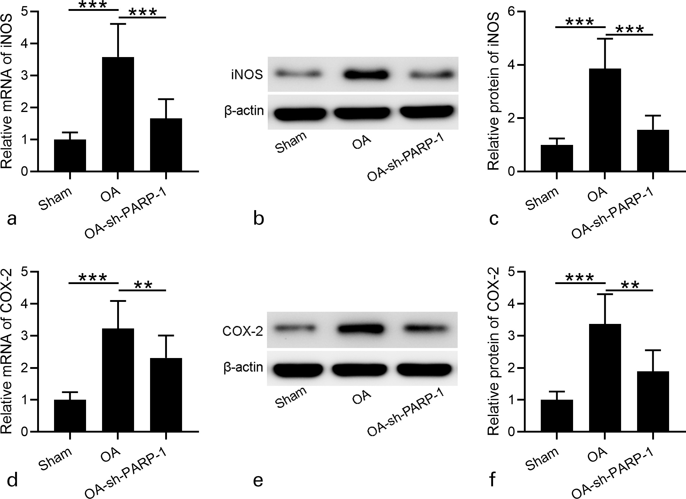 Fig. 6 
            Effects of intra-articular injection of poly (ADP-ribose) polymerase 1 (PARP-1) shRNA (short hairpin (sh)-PARP-1) on the expression of inducible nitric oxide synthase (iNOS) and cyclooxygenase-2 (COX-2) in cartilage of rats 12 weeks after anterior cruciate ligament transection (ACLT) plus medial meniscus removal (MMx). a) and d) Real-time quantitative reverse transcription polymerase chain reaction (RT-qPCR) was used to analyze the messenger RNA (mRNA) expression levels of iNOS and COX-2 in cartilage. b) and e) Western blotting was used to assay the protein expression of iNOS and COX-2 in the cartilage. c) and f) Relative expression levels of iNOS and COX-2 are shown, which were normalized to the corresponding sham. N = 12 in each group. Data are presented as mean (standard deviation (SD)). **p < 0.01, ***p < 0.001 between the indicated groups. One-way analysis of variance (ANOVA) followed by Dunn's multiple comparisons test. OA, osteoarthritis.
          