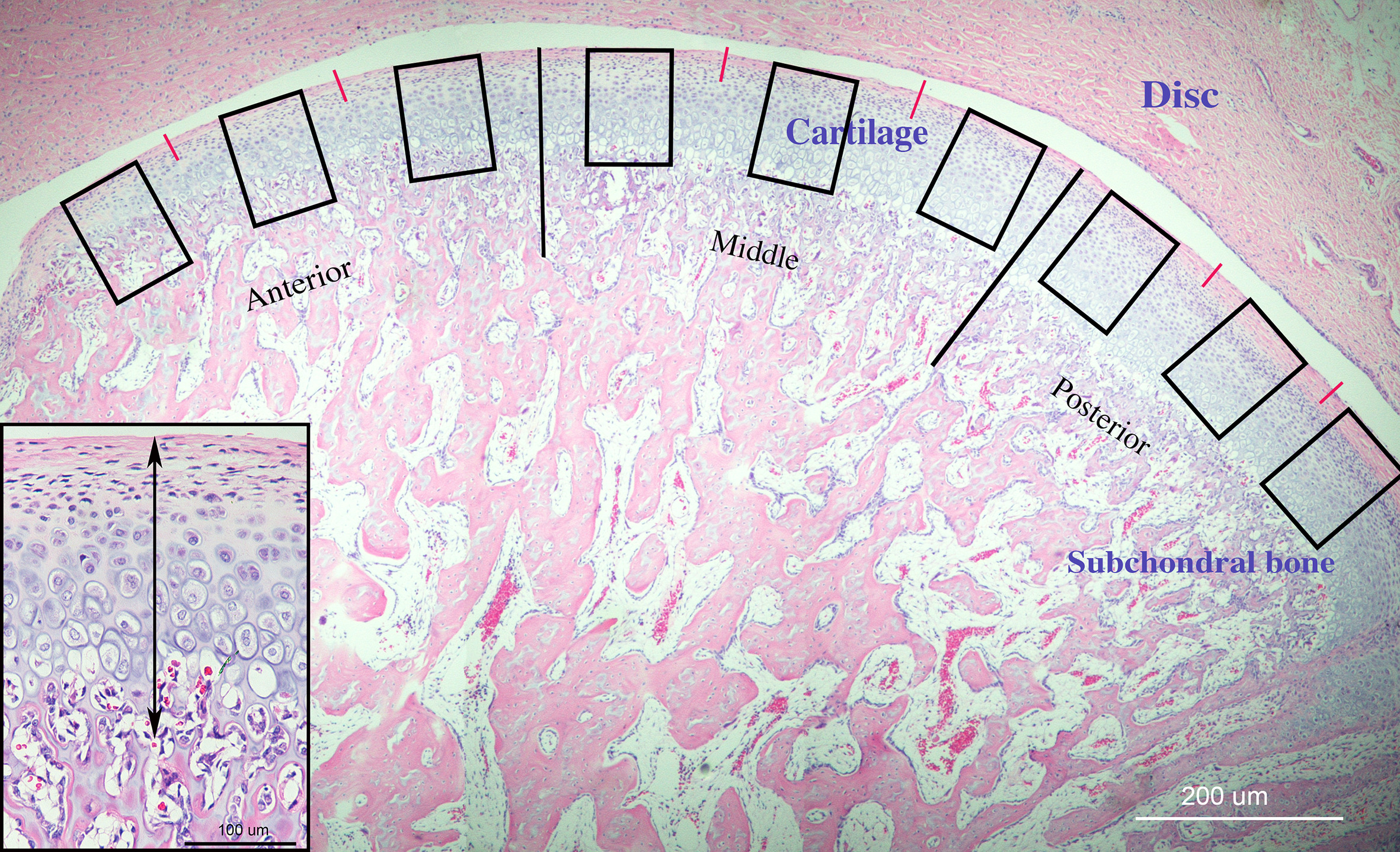 Fig. 1 
            The method, in which mandibular condylar cartilage was measured and divided, was shown in haematoxylin and eosin staining.
          
