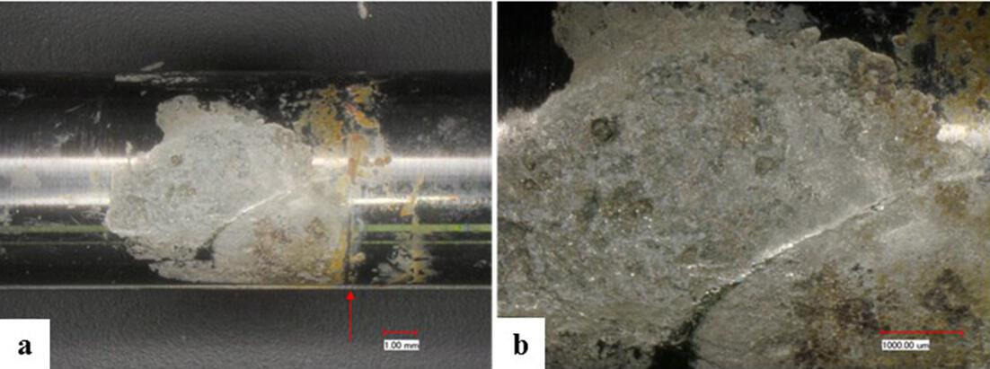 Fig. 6 
            Images of the corrosive attack at the nail’s telescopic part taken with digital microscope at a) 20× and b) 50× magnification, respectively (patient no. 3, female, 16 years). The red arrow indicates the position of the telescopic junction prior to lengthening. Absence of corrosion in the area not connected to the crown. The nail was removed after osseous consolidation 12 months postoperatively.
          