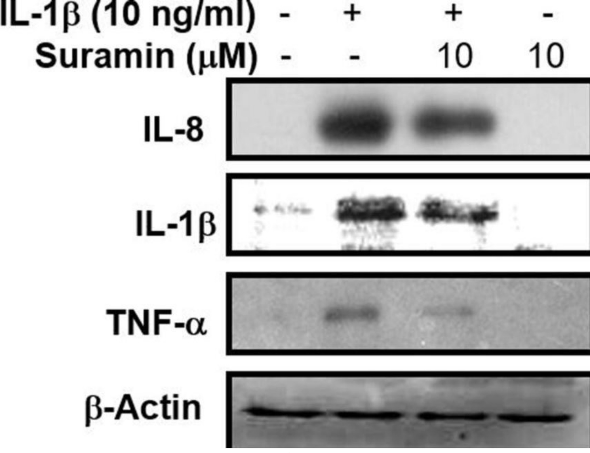 Fig. 7 
            Effect of suramin on interleukin (IL)-1β-induced proinflammatory cytokines production. Nucleus pulposus (NP) cells were treated with 10 ng/ml IL-1β for 24 hours, following pretreatment with vehicle or 10 μM suramin for one hour. The cell lysates were collected for western blot to measure the IL-1, IL-8, and tumour necrosis factor alpha (TNF-α), respectively. The expression of glyceraldehyde 3-phosphate dehydrogenase (gapdh) or β-actin was used as an internal control of real-time polymerase chain reaction or Western blot, respectively.
          