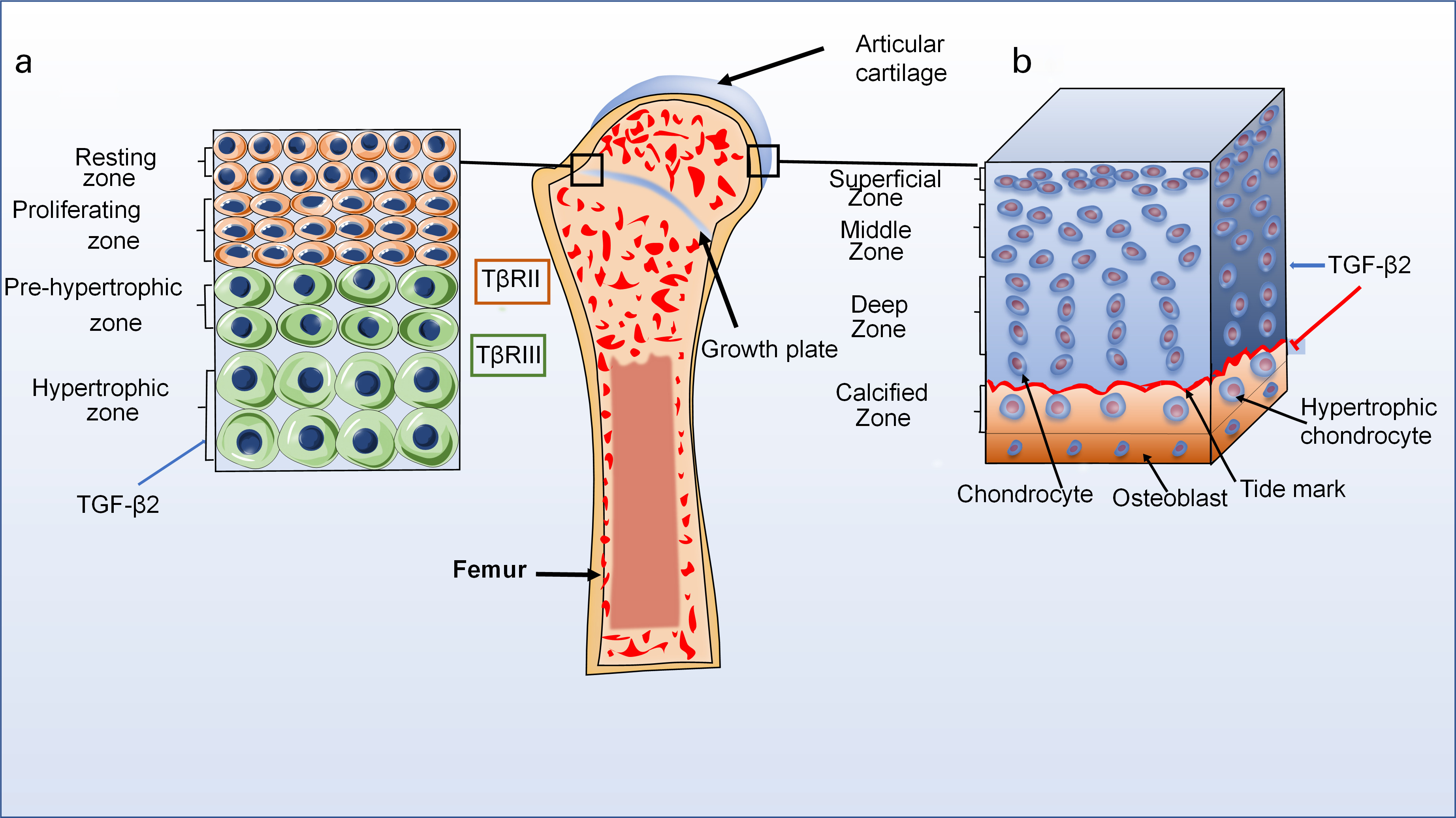 Fig. 3 
          The distribution of transforming growth factor-beta2 (TGF-β2) in normal articular cartilage. a) Normal structure diagram of growth plate (left). The growth plate cartilage is divided into four zones: resting zone, proliferative zone, pre-hypertrophic zone, and hypertrophic zone. TGF-β2 can be expressed in all zones during cartilage development, but the highest levels are in hypertrophy zone. Interestingly, TGF-β2 has low affinity for transforming growth factor beta receptor (TβR)II but a strong affinity for TβRIII. b) Normal structure diagram of articular cartilage (right). The articular cartilage is also divided into four zones: superficial zone, middle zone, deep zone, and calcified zone. TGF-β2 signalling pathways can maintain chondrocyte phenotype, and inhibit pre-hypertrophic and hypertrophic differentiation in articular cartilage.
        