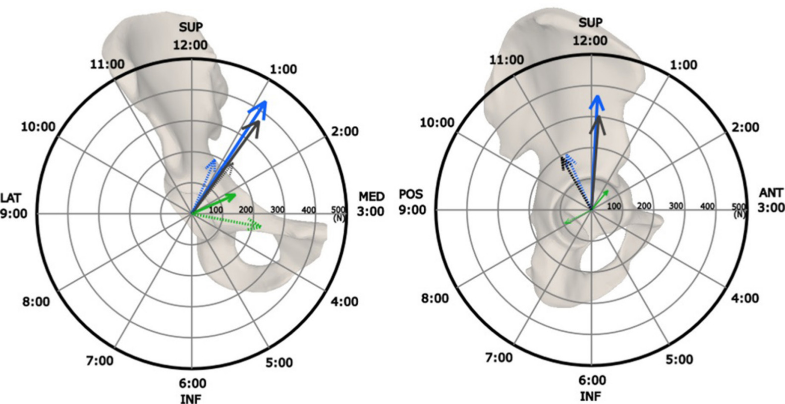 Fig. 3 
            Net force vector generated by capsular ligaments at 5 Nm rotational restraint in extension, in the coronal plane (left) and sagittal plane (right); in internal rotation (dashed) and in external rotation (solid). Colours denote hip abduction/adduction: adduction (blue); neutral (black); and abduction (green). ANT, anterior; INF, inferior; LAT, lateral; MED, medial; POS, posterior; SUP, superior.
          