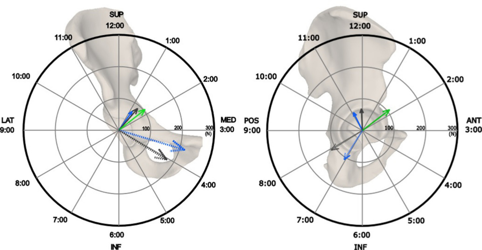 Fig. 4 
            Net force vector generated by capsular ligaments at 5 Nm rotational restraint in flexion 90°, in the coronal plane (left) and sagittal plane (right); in internal rotation (dashed) and in external rotation (solid). Colours denote hip abduction/adduction: adduction (blue); neutral (black); and abduction (green). ANT, anterior; INF, inferior; LAT, lateral; MED, medial; POS, posterior; SUP, superior.
          