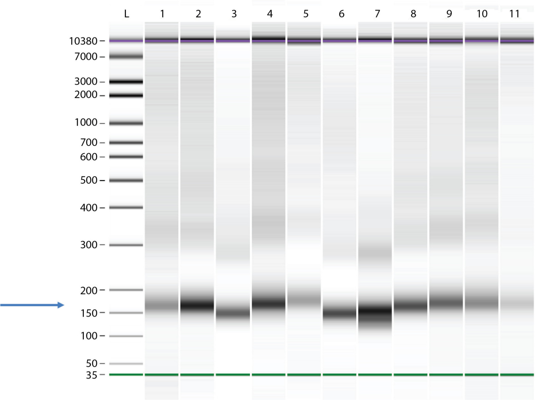 Fig. 1 
            Cell-free DNA fragment size assessment by capillary electrophoresis. Lane L contains the molecular weight ladder; Lanes 1 to 11 contain extracted DNA samples for 11 individual cases. All samples tested contained signal peaks corresponding to DNA fragments of 140 bp to 200 bp, consistent with cell-free DNA (blue arrow). The purple lines indicate the upper marker (10,380 bp) while the green lines indicate the lower marker (35 bp).
          