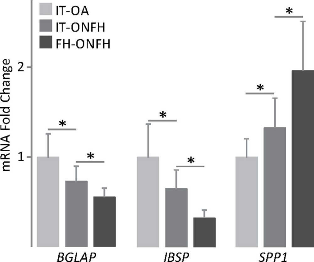 Fig. 6 
            Expression of mineralization-related genes in osteoblasts from patients with osteonecrosis of the femoral head (ONFH). Bone gamma-carboxyglutamate protein (BGLAP), integrin binding sialoprotein (IBSP), and secreted phosphoprotein 1 (SPP1) messenger RNA (mRNA) levels in osteoblasts obtained from the intertrochanteric region (IT) of patients with osteoarthritis (OA) or ONFH and from the femoral head of patients with ONFH, and cultured in osteogenic medium for 18 days. The data were normalized relative to those measured in osteoblasts from IT-OA, which were given an arbitrary value of 1. *p < 0.05 between the indicated conditions, Mann–Whitney U test and paired Wilcoxon test.
          