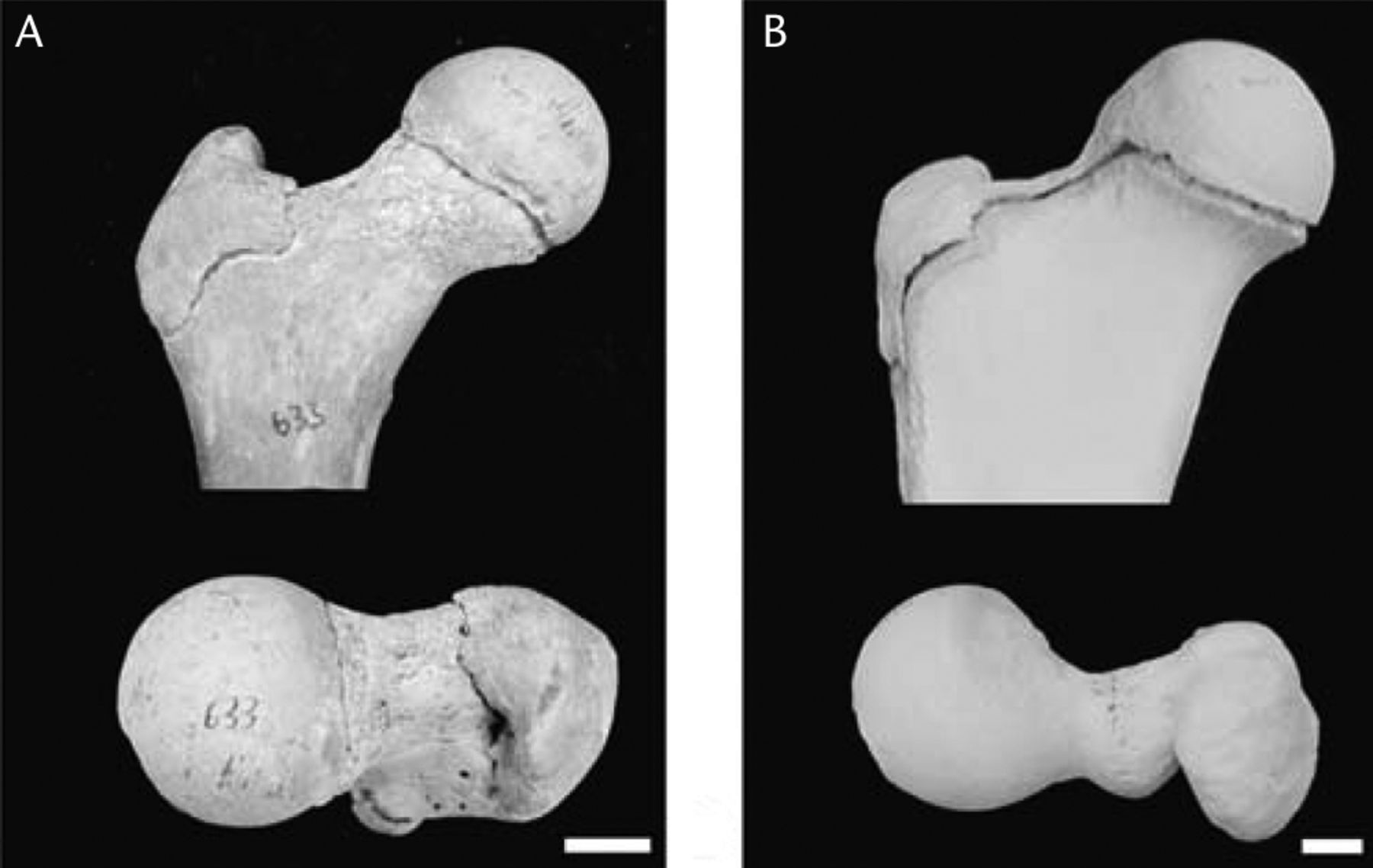 Fig. 3 
            Examples of separate and coalesced epiphyses
during development of the proximal femur. At the end of growth,
humans (A) have separation of the femoral capital epiphysis and
the trochanteric apophysis, resulting in a rounder femoral head and
longer femoral neck. Most quadripedal mammals (B) have coalescence
at the proximal femur, resulting in a shorter, stouter femoral neck,
which is more stable but with a smaller range of movement. (Reprinted
with permission: Serrat et al. Variation in mammalian
proximal femoral development: comparative analysis of two distinct
ossification patterns. J Anat 2007;210:249–258).
          
