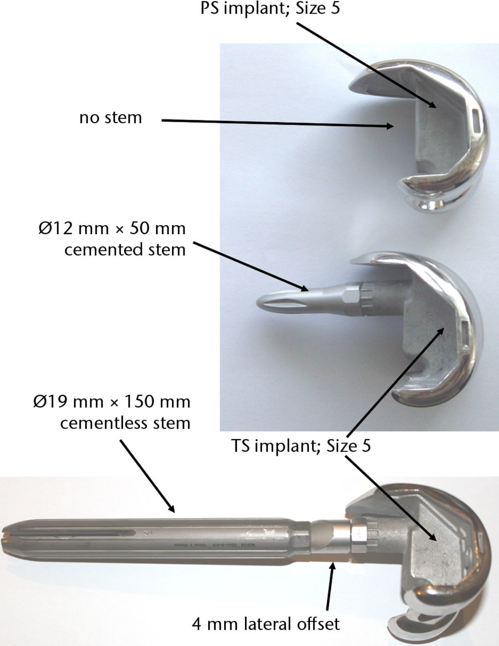 Fig. 2 
            Photographs of the implants investigated,
showing a posterior-stabilised (PS) implant (top row), a total-stabilised
(TS) implant with short stem (middle row) and a TS implant with
long offset stem (bottom row).
          