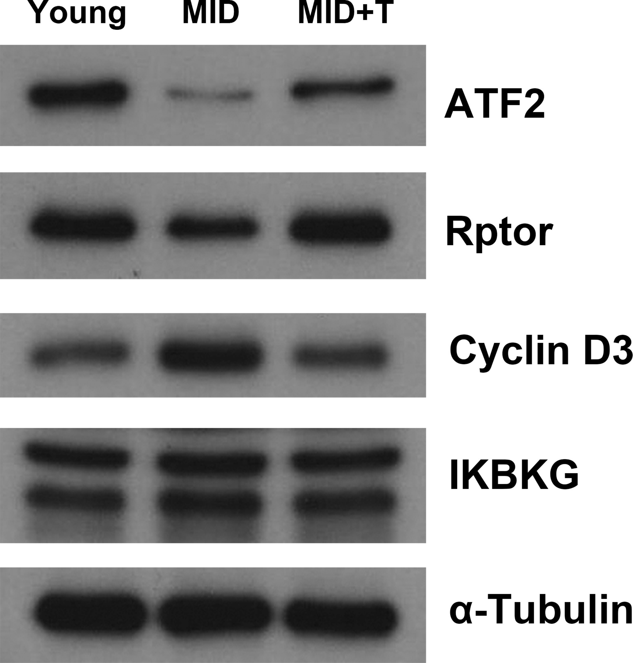 Fig. 7 
            The protein expression level of activating transcription factor 2 (Atf2), Regulatory Associated Protein Of MTOR Complex 1 (Rptor), inhibitor of nuclear factor kappa B kinase regulatory subunit γ (Ikbkg), and Cyclin D3 (Ccnd3) genes in satellite cells (SCs) from young, MID, and MID+ T groups by western blot assay. The seven-day cultured SCs from each group were lysed and the lysate was subjected to western blot assay with the indicated antibodies. α-Tubulin served as an internal control for amounts of protein loaded on the gel.
          