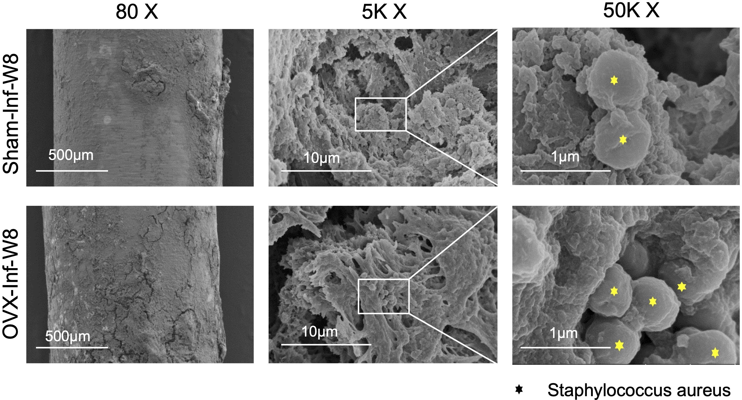 Fig. 5 
            Scanning electron microscopy imaging of biofilm formation on the Kirschner wire at week 8. OVX, ovariectomized; Sham-Inf-W8, sham with infection at week 8.
          