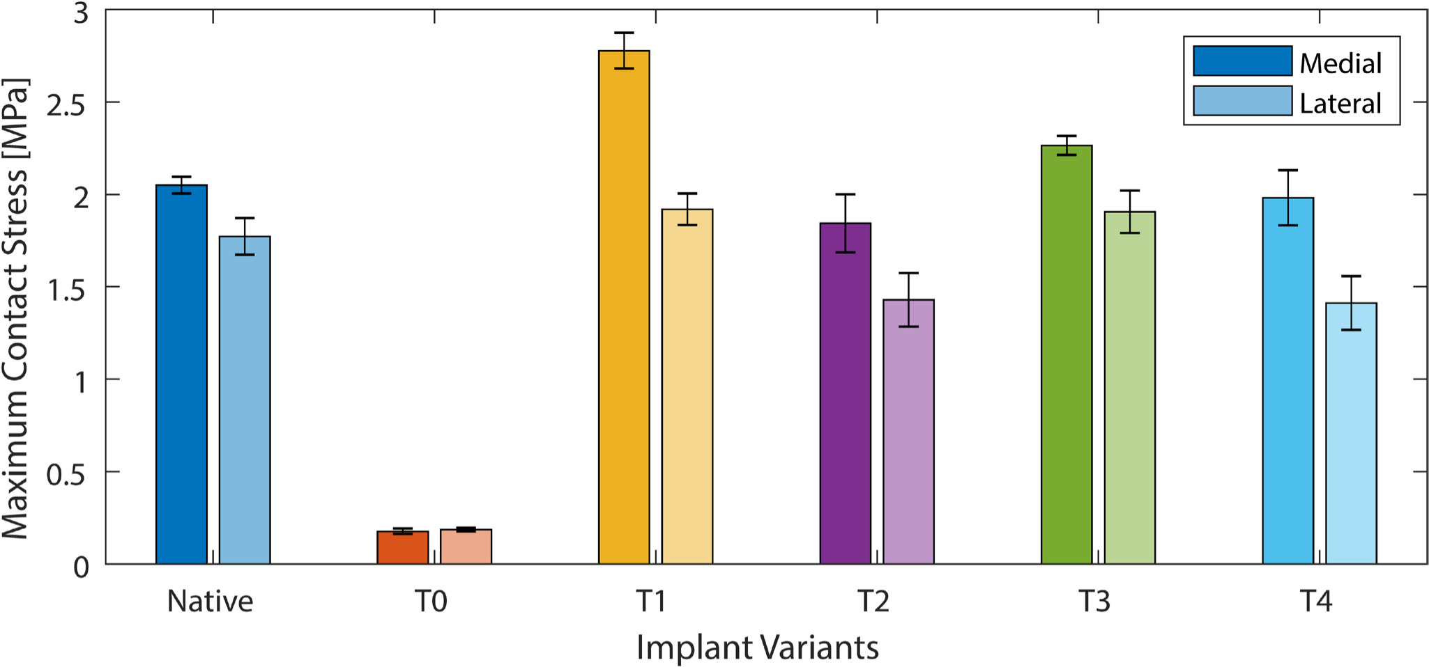 Fig. 6 
            Maximum stress for each condyle in total knee arthroplasty loading, for the native knee, conventional implant (T0), and the four additive manufactured variants (T1, T2, T3, and T4).
          