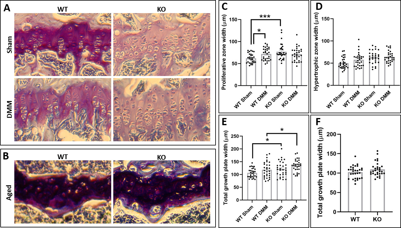 Fig. 1 
            Socs2-deficient mice exhibit widened growth plates. Histological images of toluidine blue stained growth plates in a) wild type (WT) and Socs2-/- (knockout (KO)) destabilization of medial meniscus (DMM) and sham mice, and b) aged WT and KO mice (10×). Reduced staining in the KO growth plates suggests reduced proteoglycans in these animals. Quantification of c) proliferative zone, d) hypertrophic zone, and e) total growth plate width in WT and KO DMM and sham mice. f) Quantification of total growth plate width in aged WT and KO mice. Data are presented as mean and standard error of the mean. One-way analysis of variance was used for DMM/sham animals and an independent-samples t-test for aged animals. *p < 0.05 ***p < 0.001.
          
