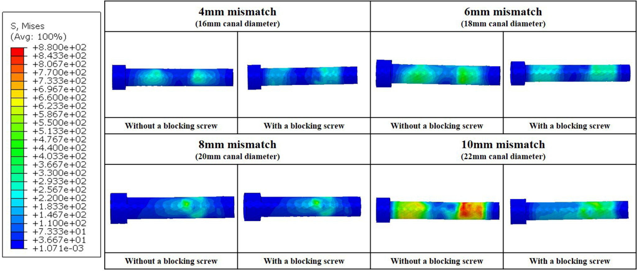 Fig. 7 
            Stress distribution on the distal locking screw in each finite element model.
          