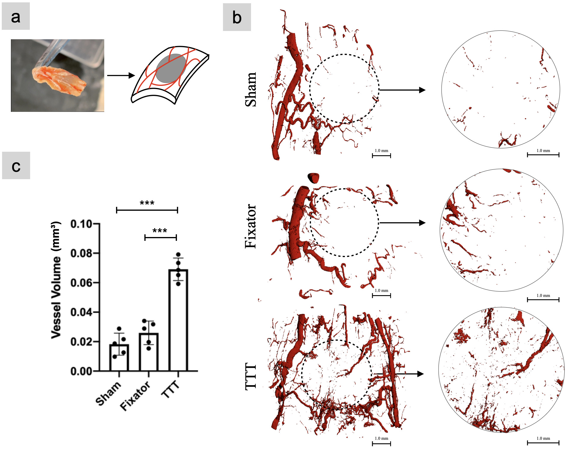 Fig. 4 
            Tibial cortex transverse transport (TTT) technique enhanced angiogenesis. a) Illustration of sample collection. The collected skin was scanned using micro-CT (μCT), while the grey round area is the region of interest (ROI) for semi-quantitative analysis. b) To perform vessel volume analysis, the ROI images in the right column were selected from the dash line circle of the left column. Results showed that more blood vessels were formed inside the newly formed skins in the TTT group. c) Quantitative analysis showed that the vessel volume in the wound area in the TTT group was significantly higher than that of the control and fixator groups (TTT vs Fixator, p < 0.001, TTT vs Sham, p < 0.001, Tukey’s multiple comparison test). Data were measured as means (standard deviations), ***p < 0.001, n = 6.
          