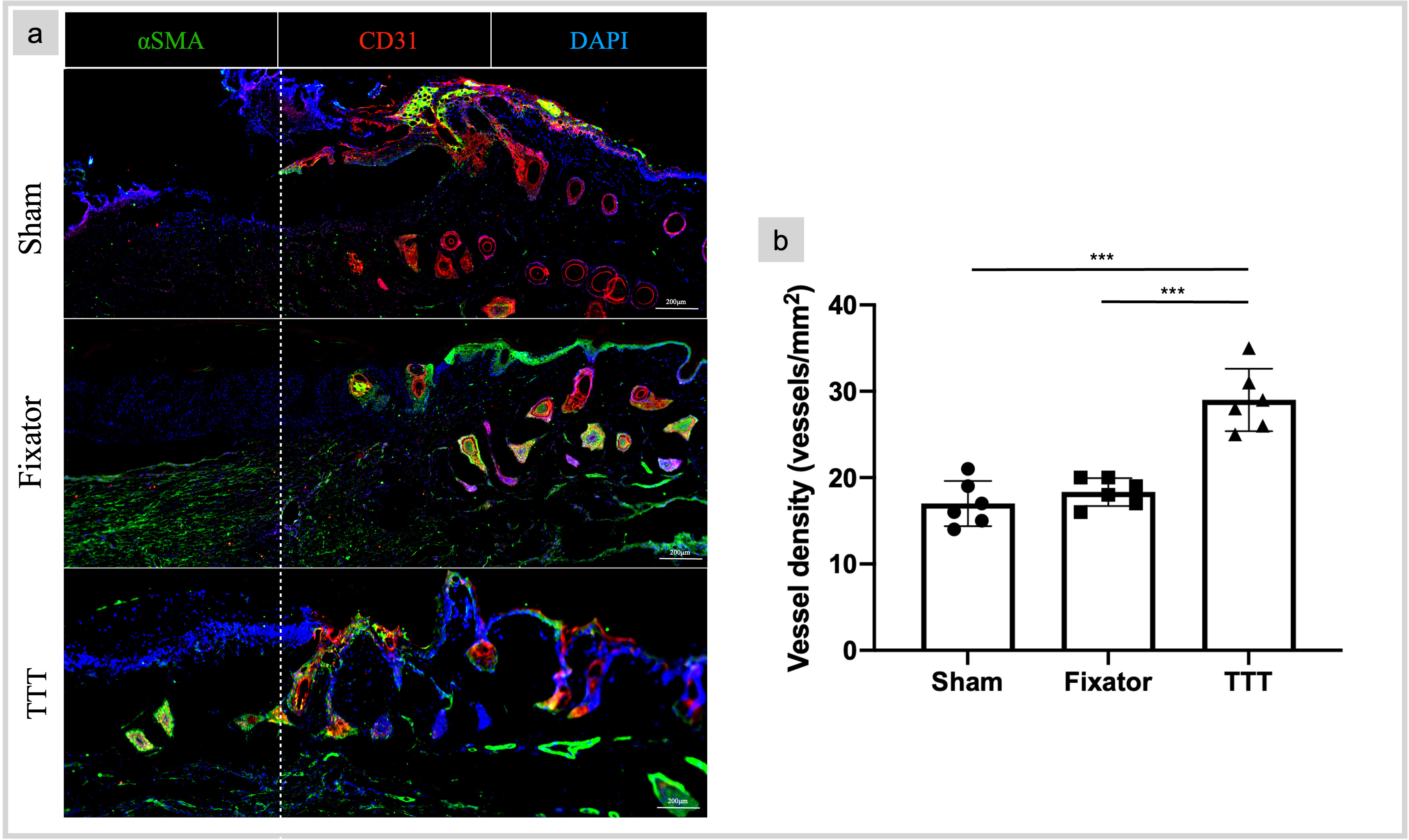 Fig. 5 
            Tibial cortex transverse transport (TTT) technique enhanced small vessels in the newly formed skins. a) Wound sections were double-labelled for CD31 (red) and α-SMA (green). Nuclei were stained with 4',6-Diamidino-2-Phenylindole (DAPI, blue). Large vessels were mainly located near the edge of healthy skin, and smaller vessels were seen inside the newly formed dermis. b) Semi-quantitative measurement of immunostaining showed that the amount of blood vessels in the TTT group was significantly higher than that of the other groups (TTT vs Fixator, p < 0.001, TTT vs Sham, p < 0.001; Tukey’s multiple comparison test). Graphics were generated by Leica Application Suite. Data were measured as means (standard deviations), ***p < 0.001, n = 6.
          