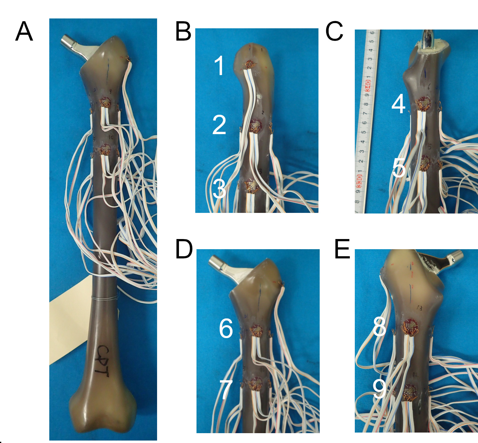 Fig. 3 
            a) The bone analogue with sensors attached. b) to e) Location of the strain sensors. b) Lateral (1, 2, and 3), c) medial (4 and 5), d) anterior (6 and 7), and e) posterior (8 and 9).
          