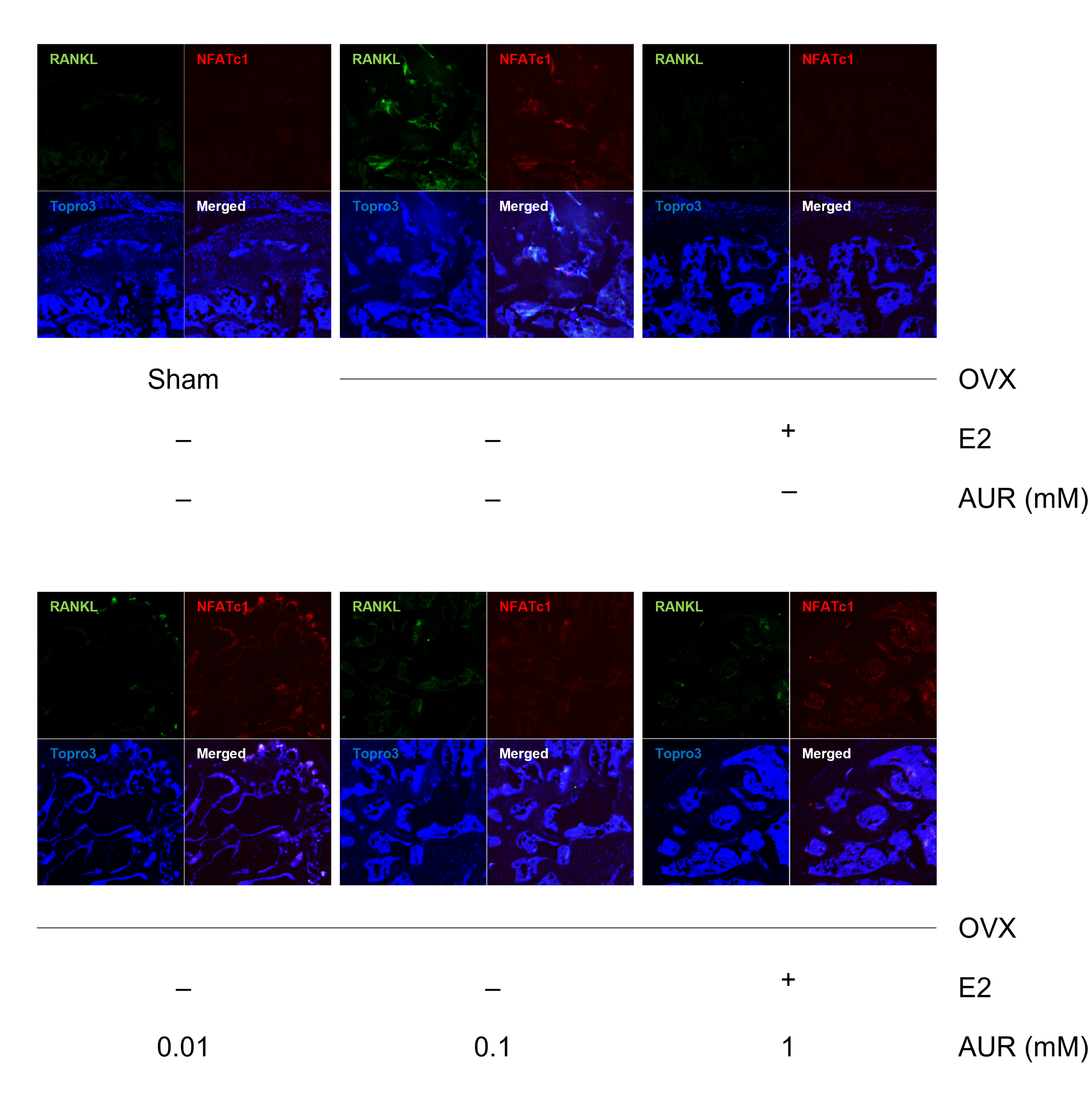 Fig. 5 
            Effects of auraptene (AUR) on receptor activator of nuclear factor kappa-Β ligand (RANKL)+nuclear factor of activated T cells 1 (NFATc1)+ expressions in the femoral body in ovariectomized (OVX)-induced mice (magnification 200×, scale bar = 20 μm). Green, RANKL; Red, NFATc1; Blue, Topro3. E2, 17β-estradiol group.
          