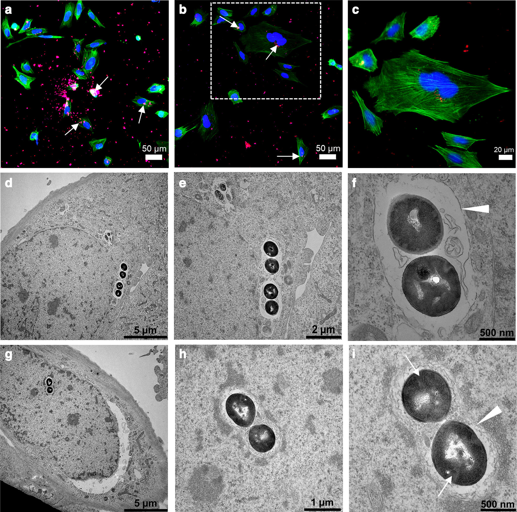 Fig. 1 
            Intracellular invasion of Staphylococcus aureus in osteoblasts. a) to c) Immunofluorescence images showing clusters of S. aureus EDCC 5055 that are localized inside the Saos-2 cells at three hours post-infection. The S. aureus (white arrows), nuclei, and actin filament are stained in red, blue, and green, respectively. d) to i) Ultrastructural imaging of intracellular S. aureus EDCC 5055 revealed internalized bacteria clusters localized close to the cell nuclei membrane. Most bacteria clusters possess intact cell wall/plasma membrane and are surrounded by phagosomal membrane (white arrowheads). Some proliferating bacteria revealed division septa (white arrows).
          
