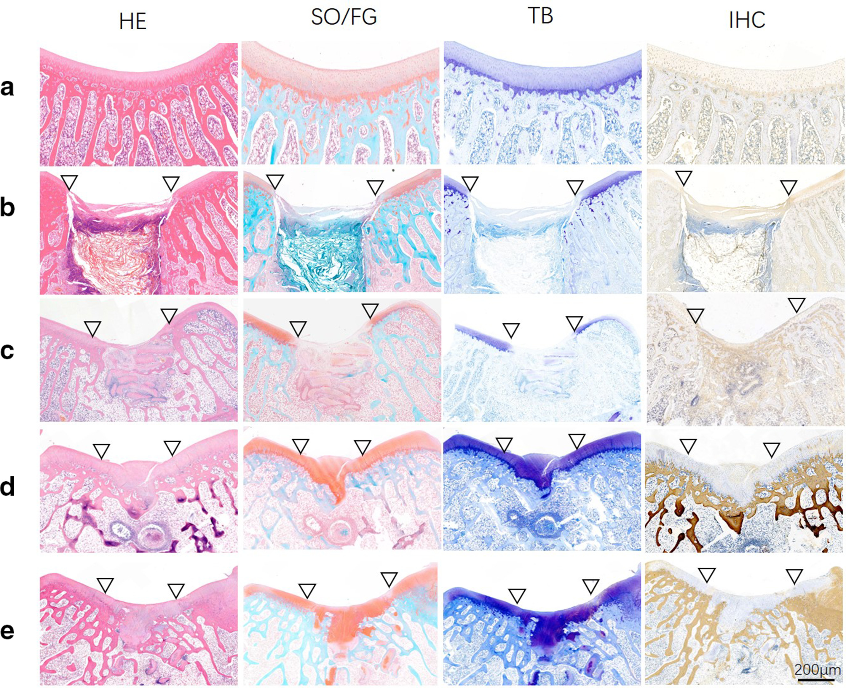 Fig. 10 
            Histological assessment of regenerated tissue in all groups at 12 weeks after surgery (n = 5). ∇: boundary of defects. a) Normal group. b) Control group. c) Juvenile cartilage fragments (JCFs) group. d) Human acellular amniotic membrane (HAAM) group. e) HAAM + JCFs group. HE, haematoxylin and eosin; IHC, immunohistochemical staining; SO/FG, Safranin O/Fast Green staining; TB, toluidine blue staining of type II collagen. Scale bar: 200 μm.
          