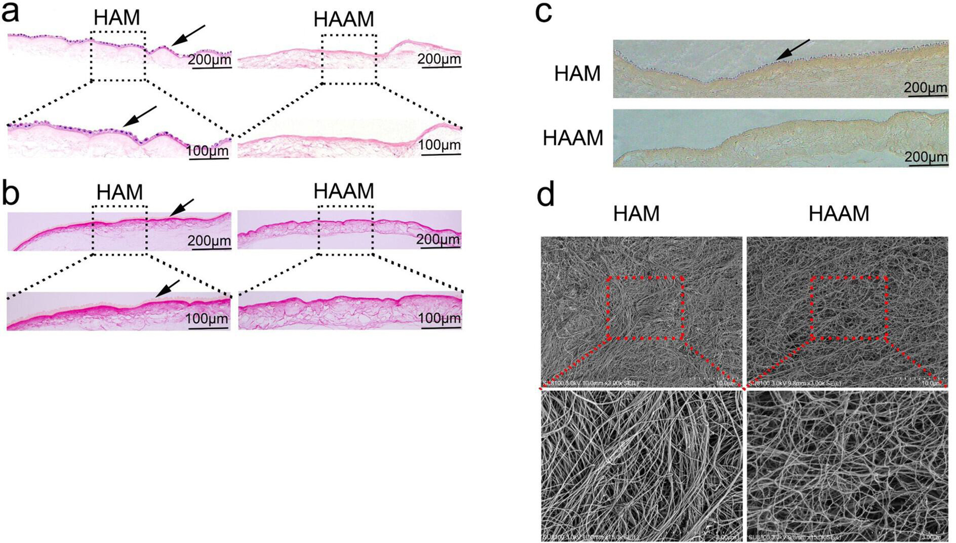 Fig. 6 
            Characterization of the human acellular amniotic membrane (HAAM) scaffolds. a) Haematoxylin and eosin staining. b) Picrosirius red staining. c) Immunohistochemical staining of collagen II. d) Scanning electron microscope observation. The black arrows indicate the epithelial cells on fresh human amniotic membrane (HAM).
          