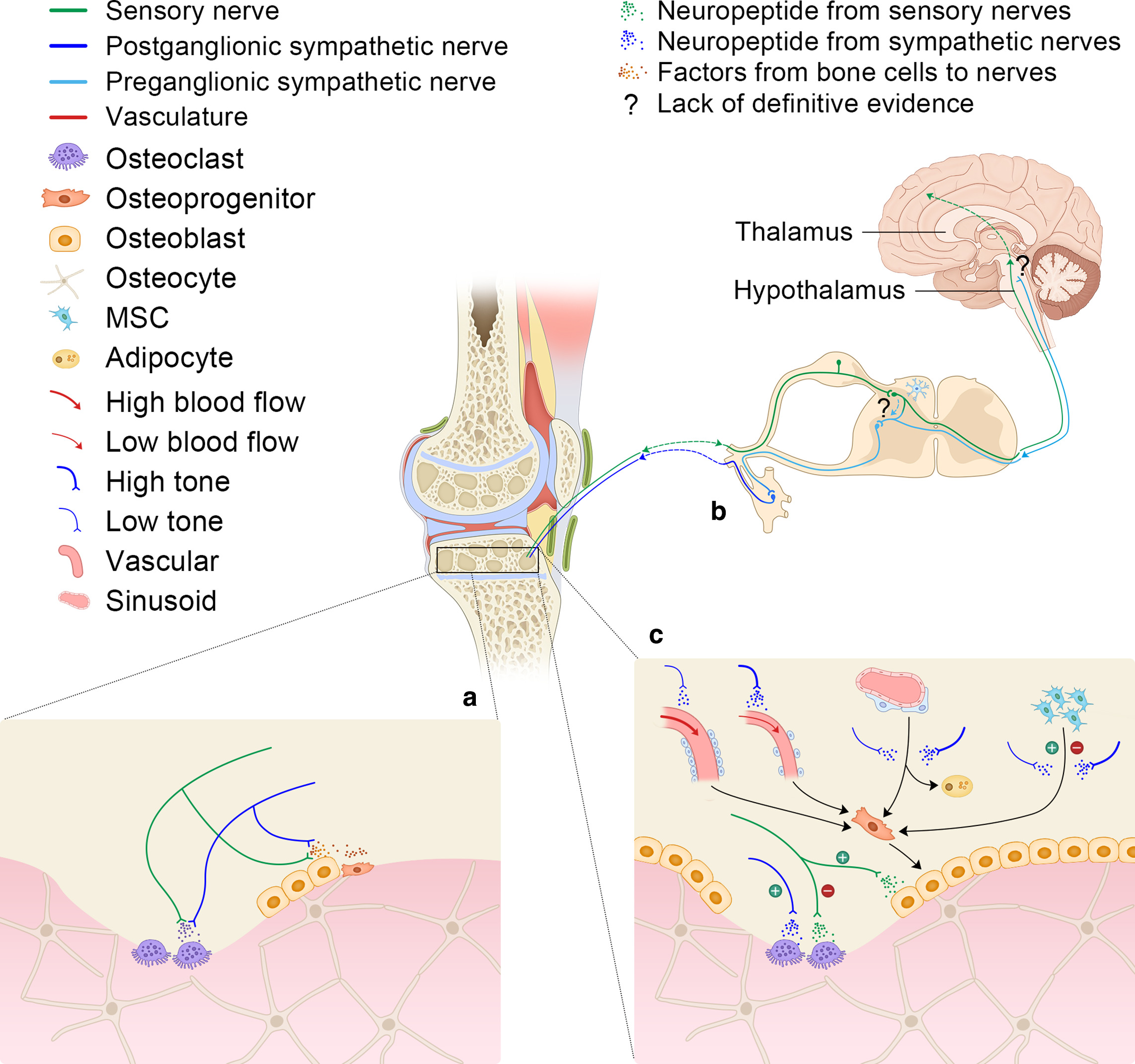 Fig. 3 
            The schematic of regulation of peripheral nerves in subchondral bone homeostasis and pain sensation. a) The local factors and molecules from resident cells, including osteoblast, osteoclast, and osteoprogenitors or other cells, activate sensory nerves, and then they mediate both metabolic and pain signals to central nervous system; local factors, such as netrin-1 and SLIT3, also affect both sensory nerve and sympathetic nerve by guiding their ingrowth. b) Sensory nerves collect and transport signals of peripheral tissue to brain after second-relay in the spinal cord. The pain signals are projected to brain cortex while sensory nerve mediates metabolic signals and turns down the tone of sympathetic signals at hypothalamus and spinal levels. c) Sympathetic tone regulates bone remodelling both directly and indirectly. Reduced sympathetic tone that is dependent or independent of sensory activity may promote proliferation of osteoprogenitors via increase of blood flow and subsequently increased generation of type H vessel. Reduced sympathetic tone also promotes mesenchymal stem cells (MSCs) to differentiate into adipocyte and directly promote the proliferation and differentiation of osteoblast lineage cells. Sympathetic molecules including neuropeptide Y and vasoactive intestinal polypeptide promote osteoclastogenesis, and inhibit the activity and differentiation of osteoblast lineage cells. The sensory molecules, such as calcitonin gene-related peptide and substance p, have a dual role in the inhibition of osteoclast activity and promotion of osteoblast lineage cells.
          