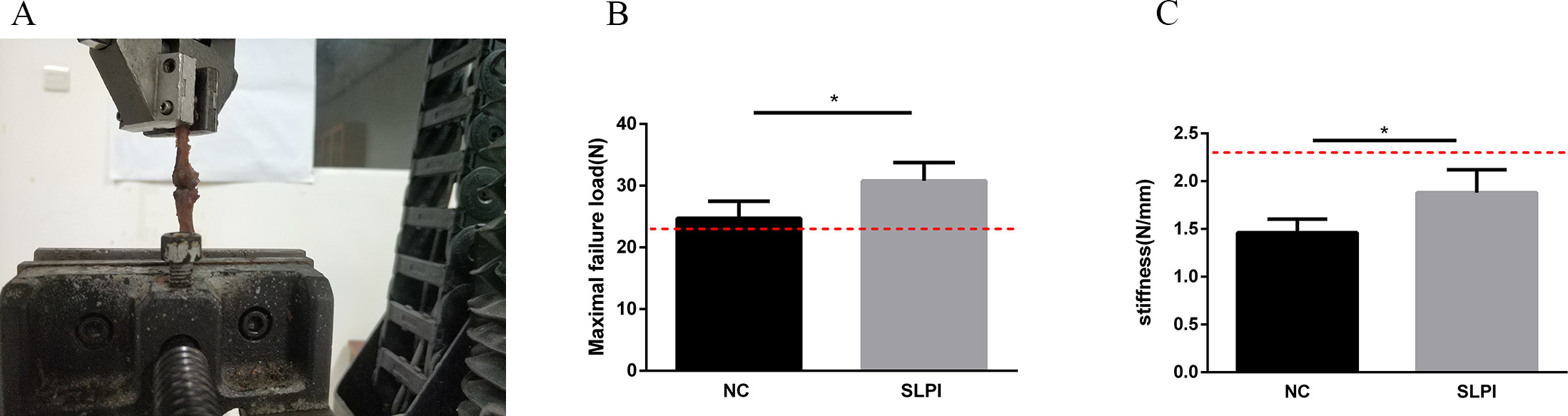 Fig. 2 
            a) Biomechanical testing performed using a biomaterial testing system. b) Maximum tensile force and c) stiffness of the secretory leucocyte protease inhibitor (SLPI) group and the negative control (NC) group were recorded. Both the maximum tensile force and stiffness were higher in the SLPI group. Results are presented as mean and standard deviation (n = 6), *p < 0.05. The red dashed line in b) and c) indicates maximum failure tension and stiffness of the intact anterior cruciate ligament.
          