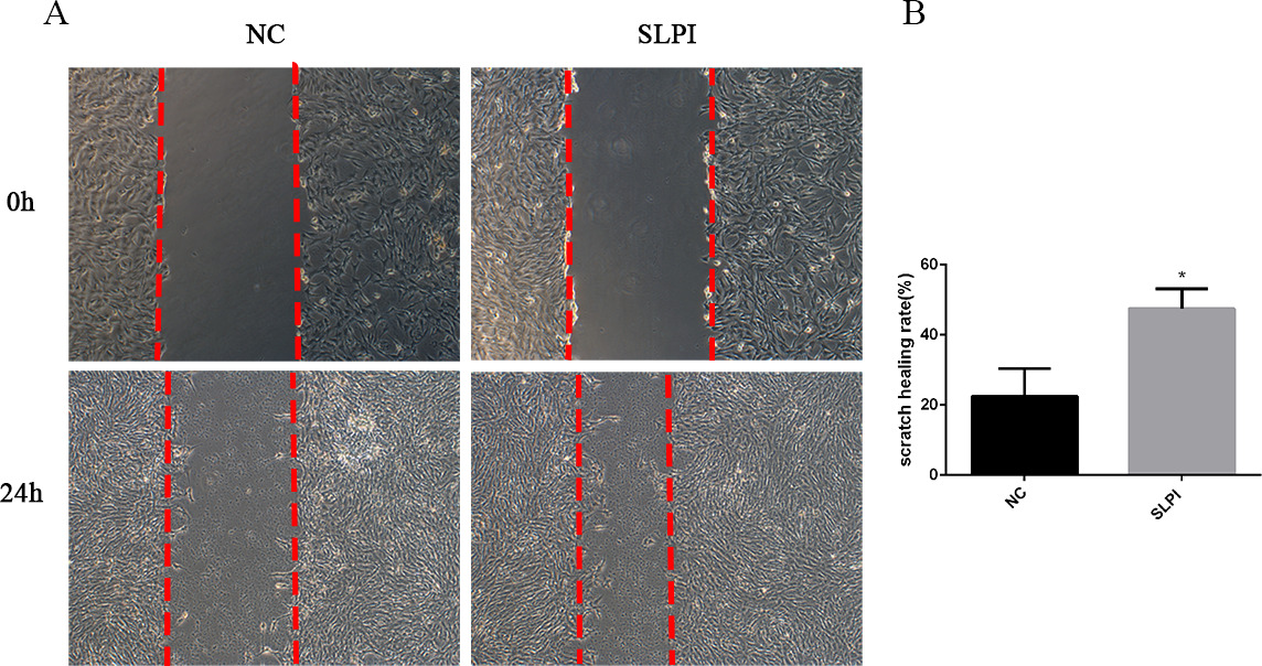 Fig. 3 
            Scratch assay was performed to evaluate cell migration (n = 3). a) Images of the secretory leucocyte protease inhibitor (SLPI) group show a small scratch area at 24 hours after addition of SLPI. b) Quantification of the scratch healing rate based on a). NC, negative control. *p < 0.05.
          