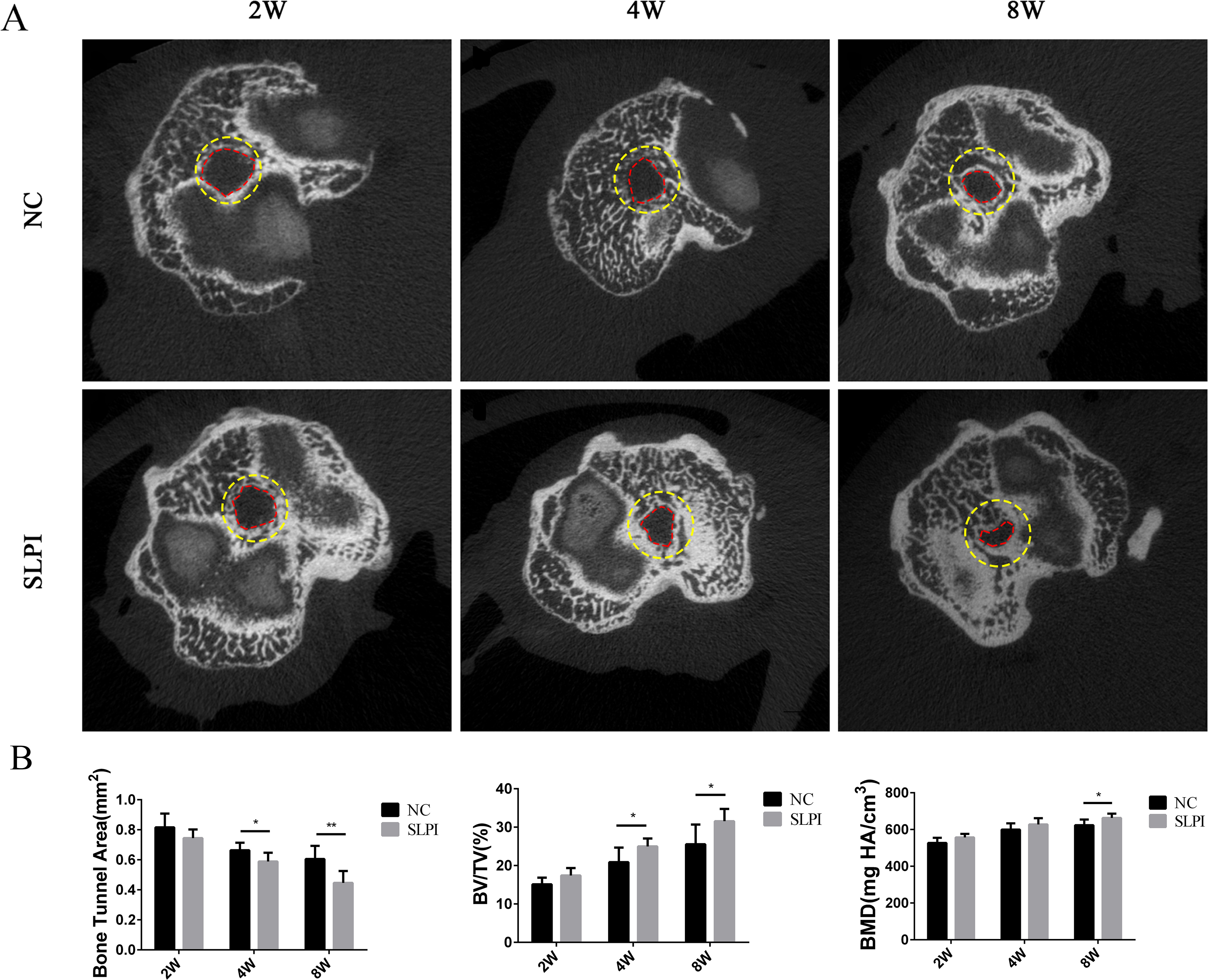 Fig. 8 
            a) Micro-CT was performed to evaluate the cross-sectional area of the tibial tunnel in the secretory leucocyte proteinase inhibitor (SLPI) and negative control (NC) groups at two, four, and eight weeks (n = 4). The planes (yellow dashed circle) were chosen at a depth of 5 mm from the tibial plateau. b) Results of bone tunnel area, bone volume/total volume (BV/TV (%)), and bone mineralization density (BMD) of the samples from each of the two groups at two, four, and eight weeks. The results are expressed as mean and standard deviations, *p < 0.05; **p < 0.01. The red dashed line indicates the outline of the bone tunnel.
          