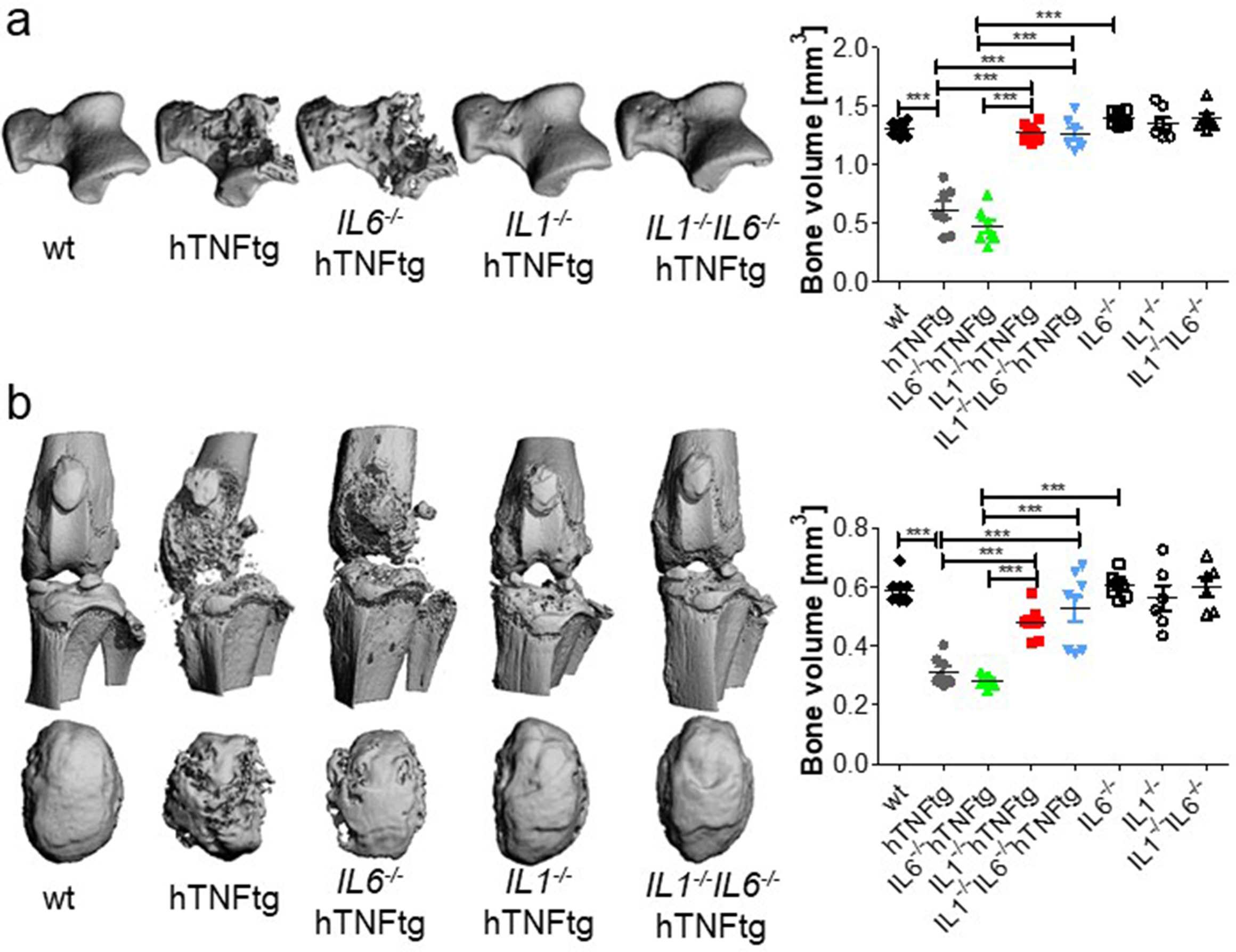 Fig. 2 
            Micro-CT (µCT)-based assessment of local inflammatory bone damage in ankle and knee joints from IL1-/-IL6-/-hTNFtg, IL1-/-hTNFtg, IL6-/-hTNFtg, and hTNFtg mice at the age of 15 weeks after birth. a) Representative 3D image from talus bone and quantitative analysis of bone volume (mm3) indicating local bone damage in arthritic mice. b) Representative 3D images from knee joints and patella, as well as quantitative analysis of bone volume (mm3) from patella indicating local bone damage or preservation of bone architecture. Data are expressed as mean (standard error of the mean (SEM)). N = 7 males per group. ***p < 0.001, one-way analysis of variance (ANOVA) and Tukey’s post hoc test. hTNFtg, human tumour necrosis factor transgenic; IL, interleukin; wt, wild-type.
          
