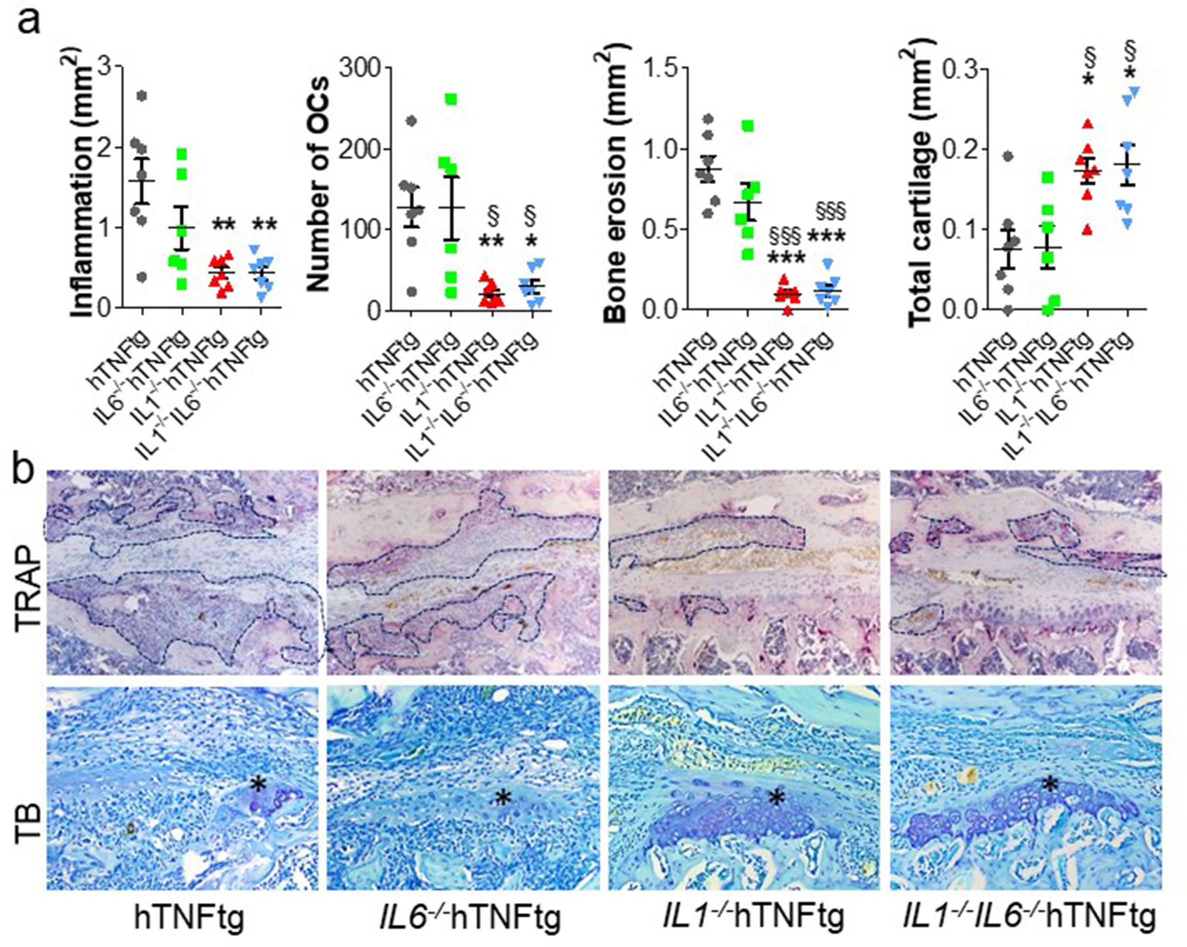 Fig. 4 
            Histopathological analysis of bilateral erosive sacroiliitis in 15-week-old IL1-/-IL6-/-hTNFtg, IL1-/-hTNFtg, IL6-/-hTNFtg, and hTNFtg mice. a) Quantitative assessment of the area of inflammation (in mm2), the number of osteoclasts (OCs), area of bone erosions (in mm2), and cartilage tissue (in mm2) assessed in both left and right sacroiliac joints. b) Representative images from tartrate-resistant acid phosphatase (TRAP) (upper row) and toluidine blue (TB) (lower row) stained sections of sacroiliac joints indicating inflammation, pannus formation (black dotted lines), erosions, and osteoclast and cartilage degradation (asterisk). Data are expressed as mean (standard error of the mean (SEM)). N = 7 to 8 animals per group. Symbols indicate statistical significance compared to * hTNFtg and § IL6-/-hTNFtg (*p < 0.05, **p < 0.005, ***p < 0.001; §p < 0.05, §§p < 0.005, §§§p < 0.001). All p-values calculated using one-way analysis of variance (ANOVA) and Tukey’s post hoc test. hTNFtg, human tumour necrosis factor transgenic; IL, interleukin.
          