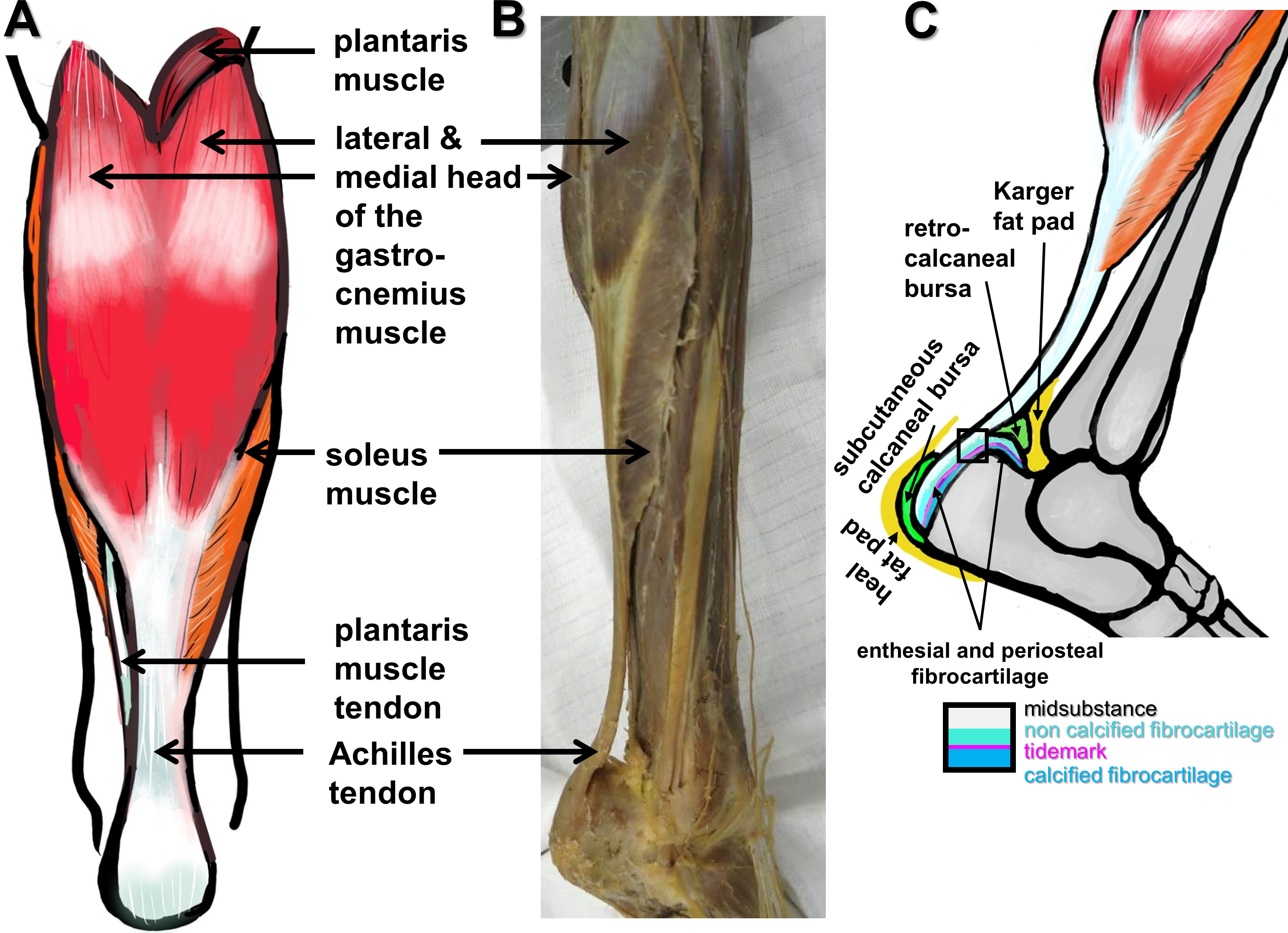 Fig. 1 
            Macroscopical anatomy of the Achilles tendon (AT). a) Scheme of a dorsal view. b) and c) Dorsolateral views: b) dissection photograph; and c) scheme of the AT, bursae, fat pads, and enthesis zones (inset). a) and c) The images were created by G. G. Schulze-Tanzil using Krita 4.1.7 (Krita Foundation, The Netherlands).
          