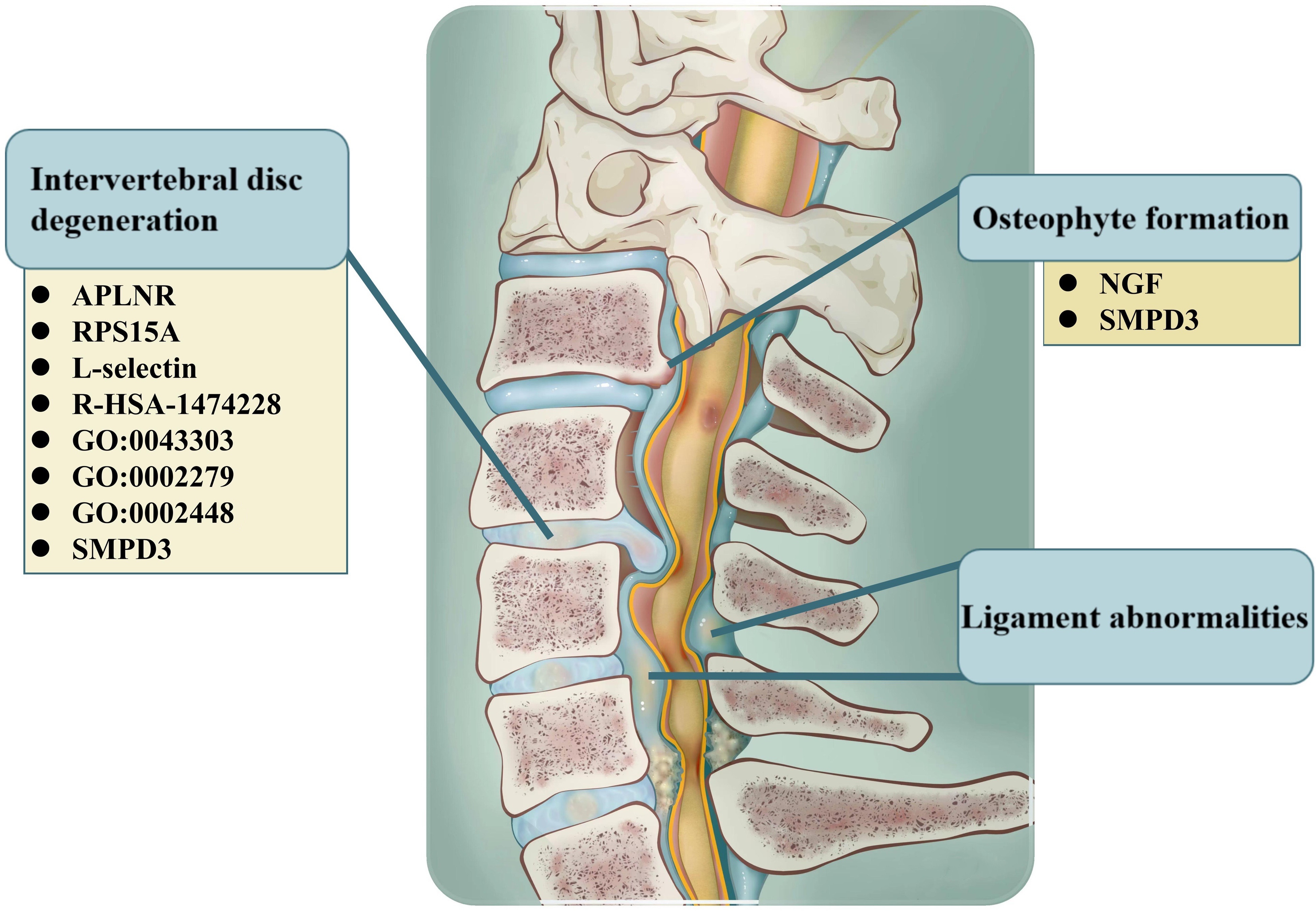 Fig. 5 
          The correlation between genetic variation and the major pathological changes of degenerative cervical spondylosis (DCS). We detected genes and pathways that may be associated with three major pathological changes in DCS including intervertebral disc degeneration, osteophyte formation, and ligament abnormalities. APLNR, apelin receptor, angiotensin receptor-like 1; HSA, homo sapiens; NGF, nerve growth factor; RPS15A, ribosomal protein S15a; SMPD3, sphingomyelin phosphodiesterase 3.
        