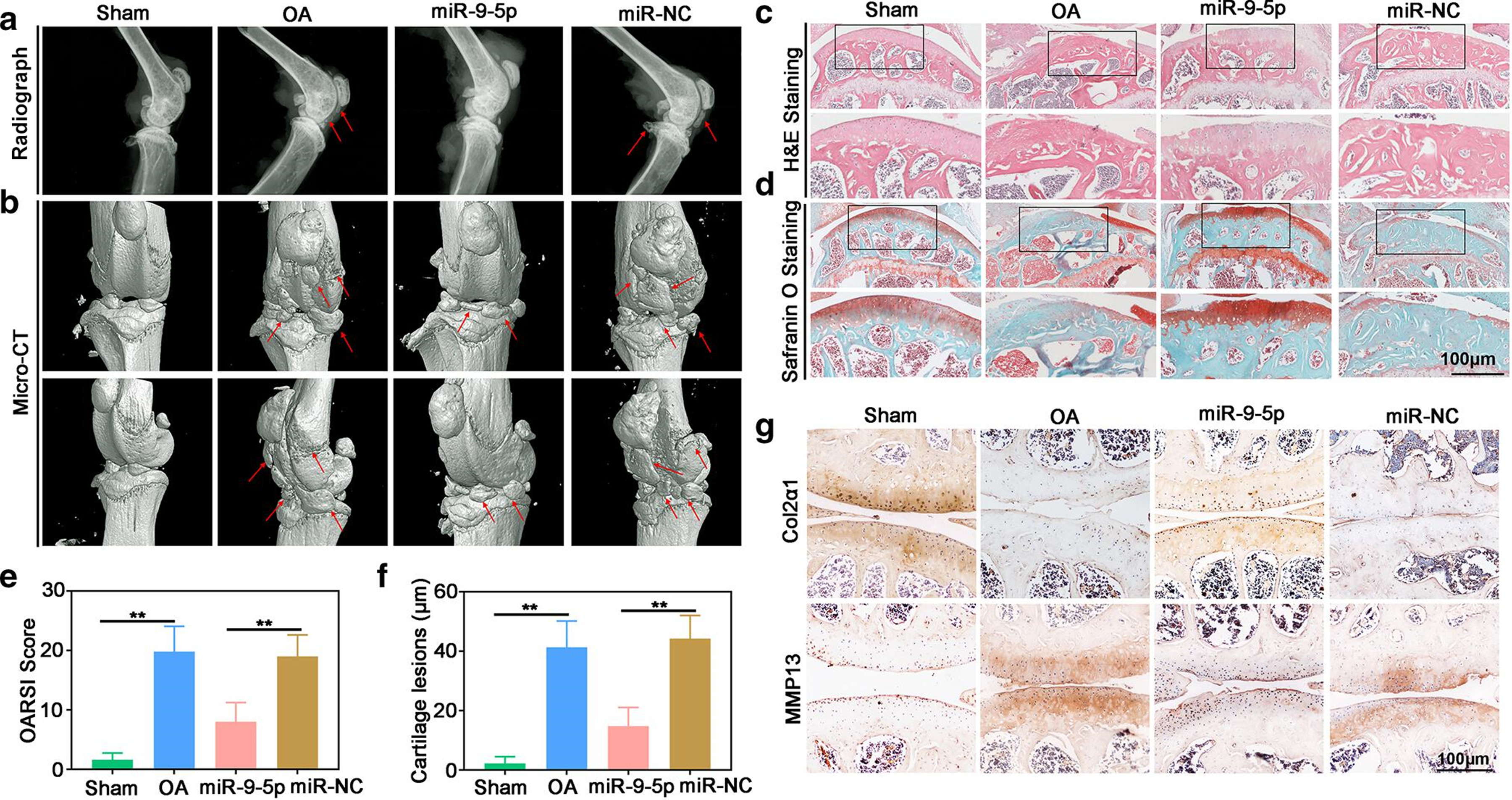 Fig. 7 
            Therapeutic effect of microRNA (miR)-9-5p in destabilized medial meniscus (DMM)-induced osteoarthritis (OA) mice. a) Radiographs and b) micro-CT imaging for morphological structure in knee of OA mouse at 12 weeks post-DMM surgery, followed by treatment with intra-articular (IA) injection of exosomes with high miR-9-5p expression and miRNA-NC, respectively (n = 4). c) and d) Haematoxylin and eosin (H&E) staining and Safranin-O/Fast Green staining of articular cartilage tissues of OA mouse at 12 weeks post-DMM surgery, followed by treatment with IA injection of exosomes with high miR-9-5p expression and miRNA-NC, respectively (n = 4; scale bar: 100 μm). e) and f) Results of Safranin-O/Fast Green staining of e) Osteoarthritis Research Society International (OARSI) score and f) depth of cartilage lesions (n = 4). g) Immunohistochemistry staining showed the intensity of immunostaining of COL2α1 and matrix metalloproteinase (MMP)-13 of OA mouse at 12 weeks post-DMM surgery, followed by treatment with IA injection of exosomes with high miR-9-5p expression and miRNA-NC, respectively (n = 4; scale bar: 100 μm). Independent-samples t-test was used to compare data between two groups, and one-way analysis of variance was used for comparison between multiple groups. NC, negative control.
          