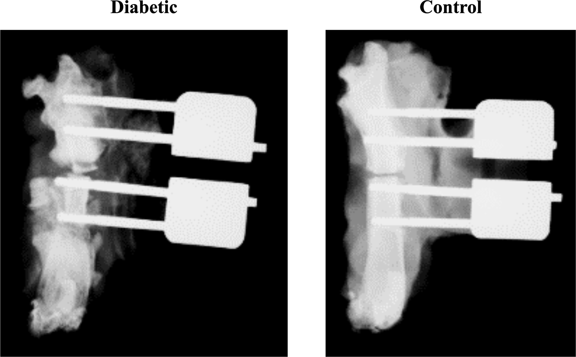 Fig. 1 
            A representative radiograph showing fracture healing of the type 2 diabetes mellitus group compared to non-diabetic controls three weeks post-femoral osteotomy, with external fixators in situ.
          