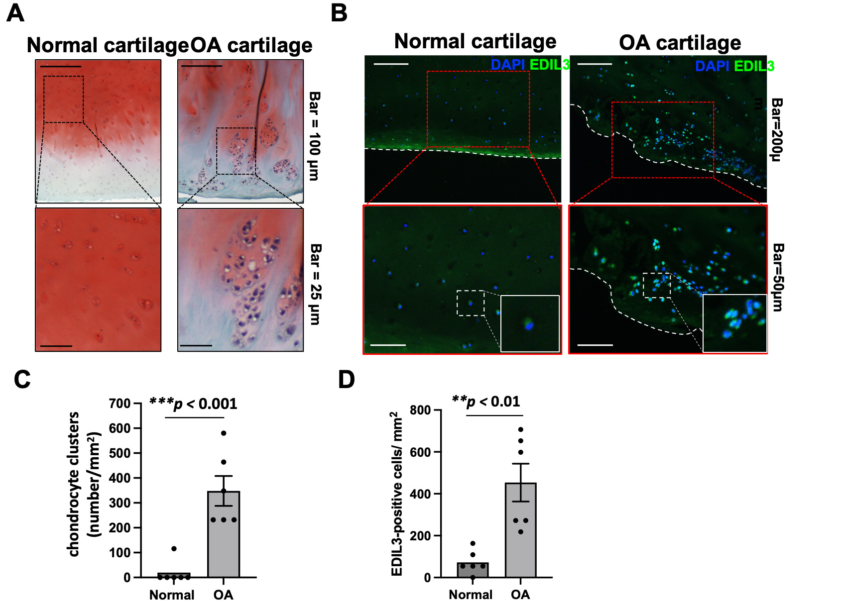 Fig. 1 
            The expression of EGF-like repeats and discoidin I-like domains-containing protein 3 (EDIL3) is higher in human osteoarthritis (OA) cartilage compared with normal cartilage. Paraffin tissue sections were established from both pathological and normal cartilage. Safranin O and immunofluorescence staining were performed for the human articular cartilage sections. a) and b) Compared with normal cartilage, OA cartilage demonstrated chondrocyte cell clustering, empty lacunae morphology, and increased EDIL3 fluorescence signal. c) and d) The chondrocyte cluster and EDIL3-positive cells in the articular cartilage were quantified. Data are presented as means and standard errors. **p < 0.05, ***p < 0.001; independent-samples t-test. DAPI, 4′,6-diamidino-2-phenylindole.
          