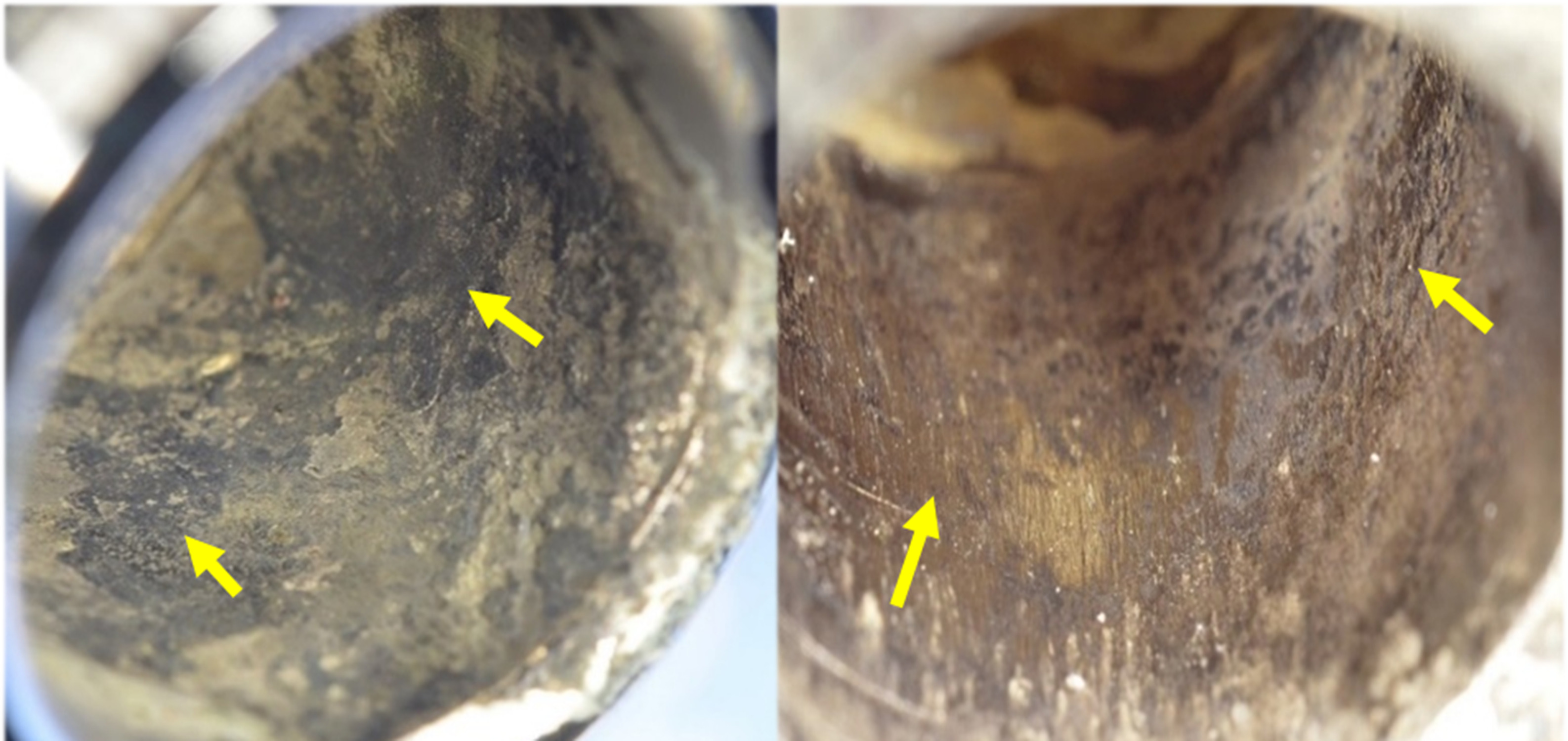 Fig. 2 
            Two examples of corrosive damage that would receive a grade of 4 using the Goldberg score due to the presence of deposits, but are further distinguished as a 6 using the visual grading system score, due to the extent or severity of the deposit, which is both thick, black, and obscures more than 50% of the contact surface, as indicated by the arrows (note: photographs were taken prior to destructive cleaning).
          