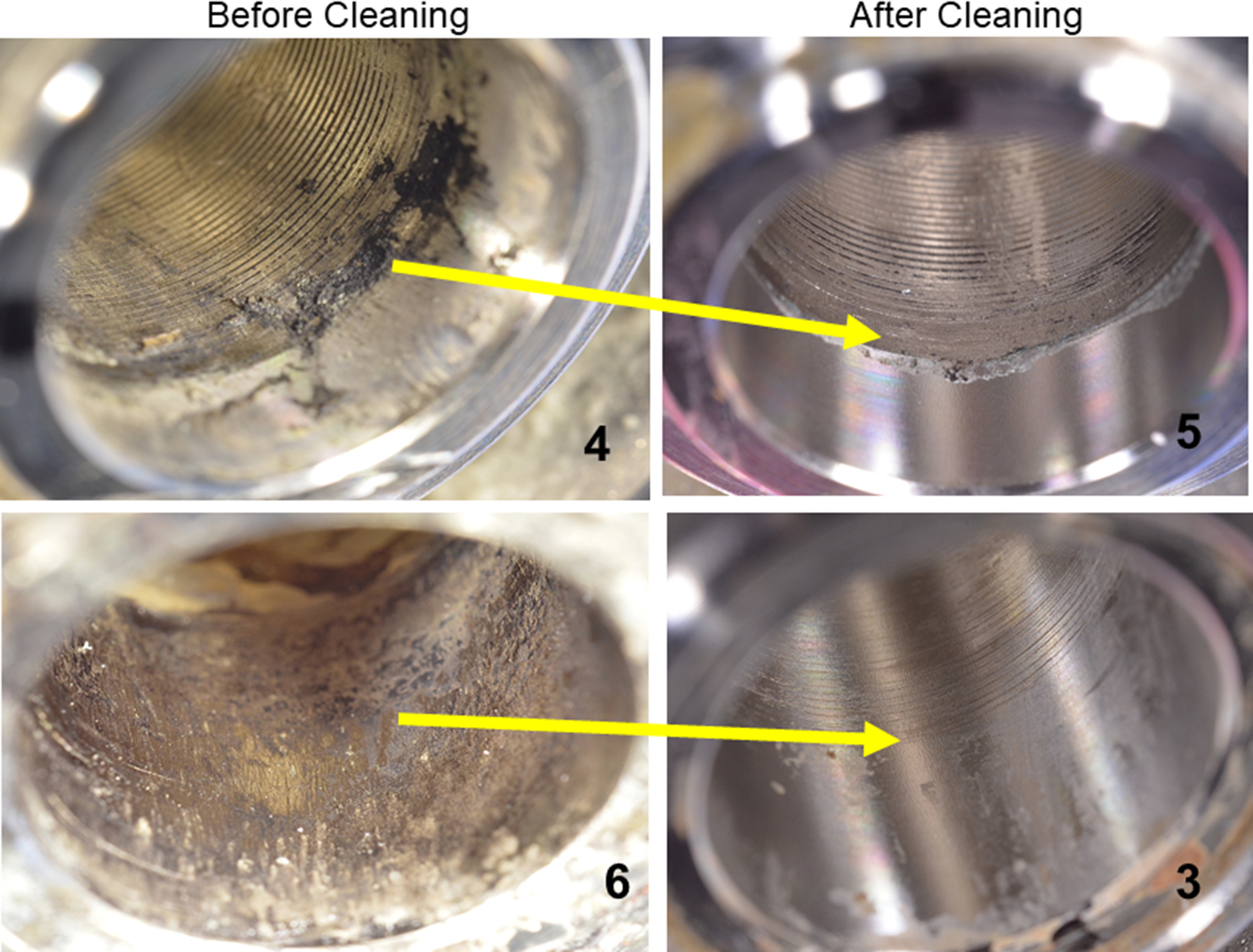 Fig. 4 
            Two examples of corrosive damage and their relative scores assigned before and after cleaning are presented. On the top row, prior to cleaning (left) the taper was assessed as a 4, using both grading scores. However, after cleaning (right), most of the dark deposits were removed, and the new Goldberg score remained the same, yet the visual grading system (VGS) score increased to a 5, due to the presence of significant, localized material loss. In contrast, on the bottom row, prior to cleaning (left) the taper was assessed as a 4 using the Goldberg score, but a 6 using the VGS, due to the extent of the thick, black deposit obscuring more than 50% of the surface. However, after cleaning (right) most of the dark deposits were removed, which changed the scores using both methods of scoring to a 3. The number in the figures indicates VGS grading score only (maximum opening at the distal taper sleeve is 14 mm).
          