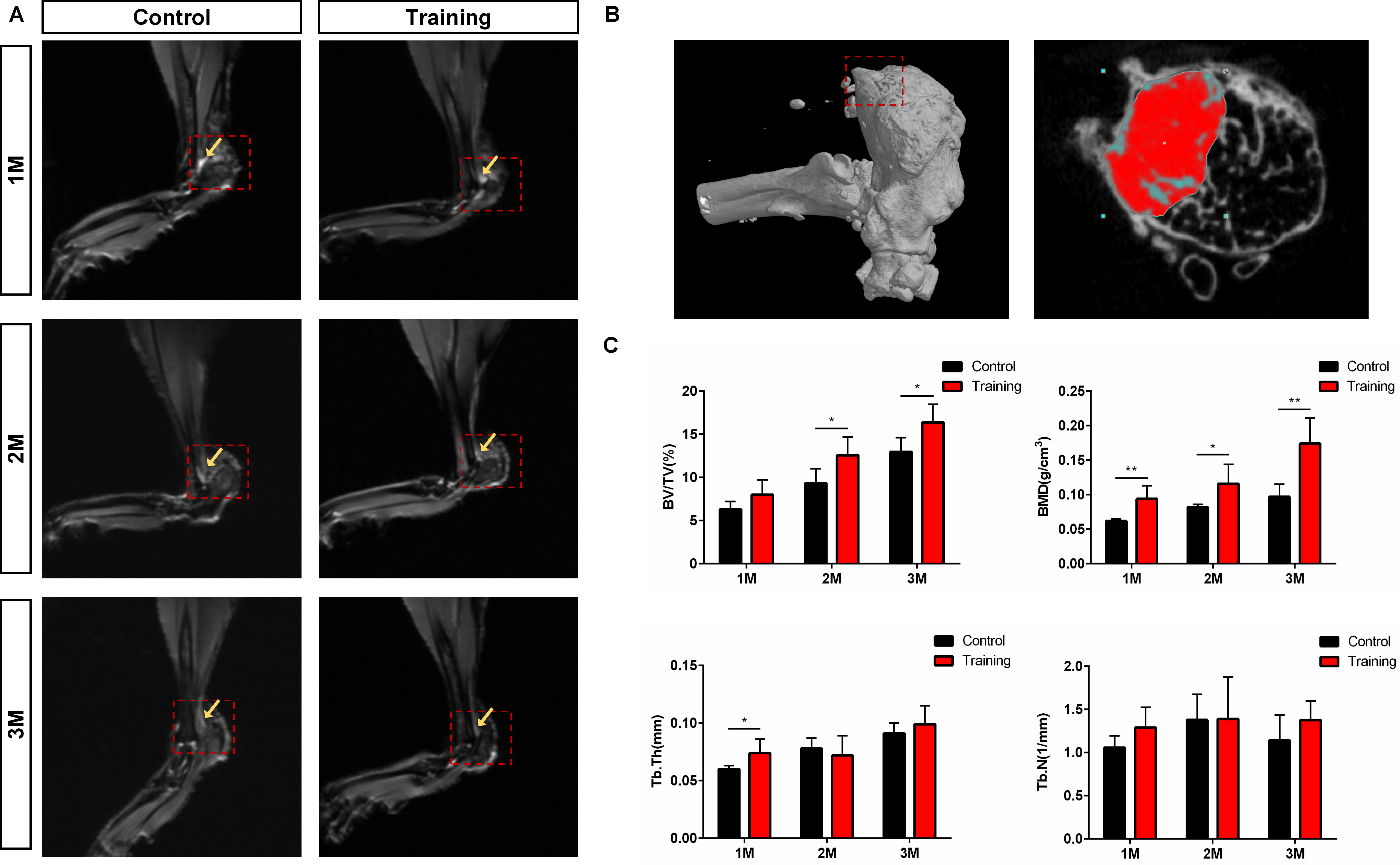 Fig. 5 
            Treadmill training promotes new bone penetration at the tendon-bone insertion and enhances bone density. a) Coronal T2-weighted image showing tendon-bone insertion; the red box indicates the tendon-bone insertion, and the yellow arrow shows the high signal area. b) The red box indicates the Achilles tendon insertion (footprint area) on the left image, and region of interest (the red area on the right image) in microCT analysis. c) The mean bone volume/total volume (BV/TV), trabecular bone thickness (Tb.Th), trabecular bone number (Tb.N), and bone mineral density (BMD) value of each group were measured. N = 5 for all groups. *p < 0.05, **p < 0.01 compared with the control groups.
          