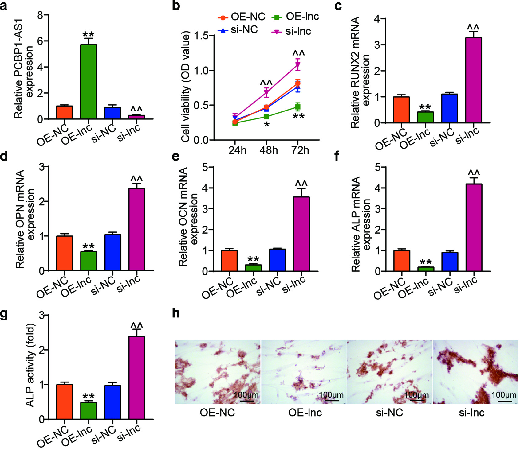 Fig. 2 
            PCBP1 Antisense RNA 1 (PCBP1-AS1) inhibited human bone marrow-derived mesenchymal stem cell (hBMSC) osteoblast differentiation. a) Transfection efficiency of PCBP1-AS1 overexpression vectors (OE-lnc) or si-PCBP1-AS1 (si-lnc) was recognized by quantitative real-time polymerase chain reaction (qRT-PCR). b) Cell proliferation of hBMSCs was measured by Cell Counting Kit-8 (CCK-8) assay. c) to f) qRT-PCR was used to determine the degree of osteogenesis-related gene expression for the genes Runt-related transcription factor 2 (RUNX2), osteopontin (OPN), osteocalcin (OCN), and alkaline phosphatase (ALP). g) ALP quantification identified ALP activity. h) Calcium deposits in hBMSCs were detected by Alizarin red staining. The data represent the mean (standard deviation). *p < 0.05, **p < 0.001 compared with empty vector (OE-NC), ^^p < 0.001 compared with negative control (si-NC); calculated using one-way analysis of variance. mRNA, messenger RNA; OD, optical density.
          