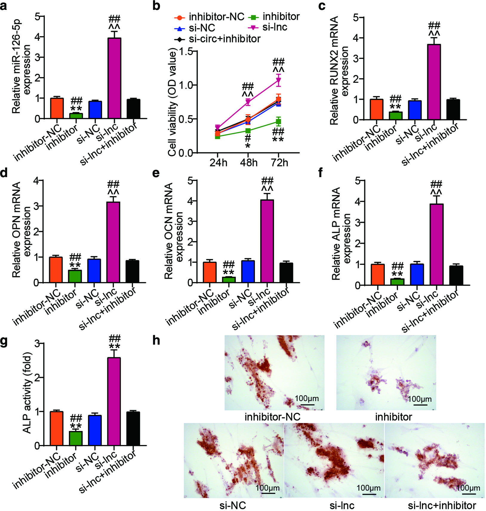 Fig. 4 
            PCBP1 Antisense RNA 1 (PCBP1-AS1) affected human bone marrow-derived mesenchymal stem cell (hBMSC) osteoblast differentiation by sponging microRNA (miR)-126-5p. hBMSCs were co-transfected hBMSCs with inhibitor-NC, miR-126-5p inhibitor (inhibitor), negative control (si-NC), si-PCBP1-AS1 (si-lnc), or si-PCBP1-AS1 + miR-126-5p inhibitor (si-lnc + inhibitor). a) The expression level of miR-126-5p in hBMSCs was detected by quantitative real-time polymerase chain reaction (qRT-PCR). b) Cell proliferation of hBMSCs was measured by Cell Counting Kit-8 (CCK-8) assay. c) to f) The expression level of osteogenesis-related genes (Runt-related transcription factor 2 (RUNX2), osteopontin (OPN), osteocalcin (OCN), and alkaline phosphatase (ALP)) were determined with the help of qRT-PCR. g) ALP activity was determined by ALP quantification. h) Calcium deposits in hBMSCs were detected by Alizarin red staining. The data represent the mean (standard deviation). *p < 0.05, **p < 0.001 compared with inhibitor-NC, ^^p < 0.001 compared with si-NC, #p < 0.05, ##p < 0.001 compared with si-lnc+ inhibitor; calculated using one-way analysis of variance. mRNA, messenger RNA; OD, optical density; si-circ, silence circle RNA.
          