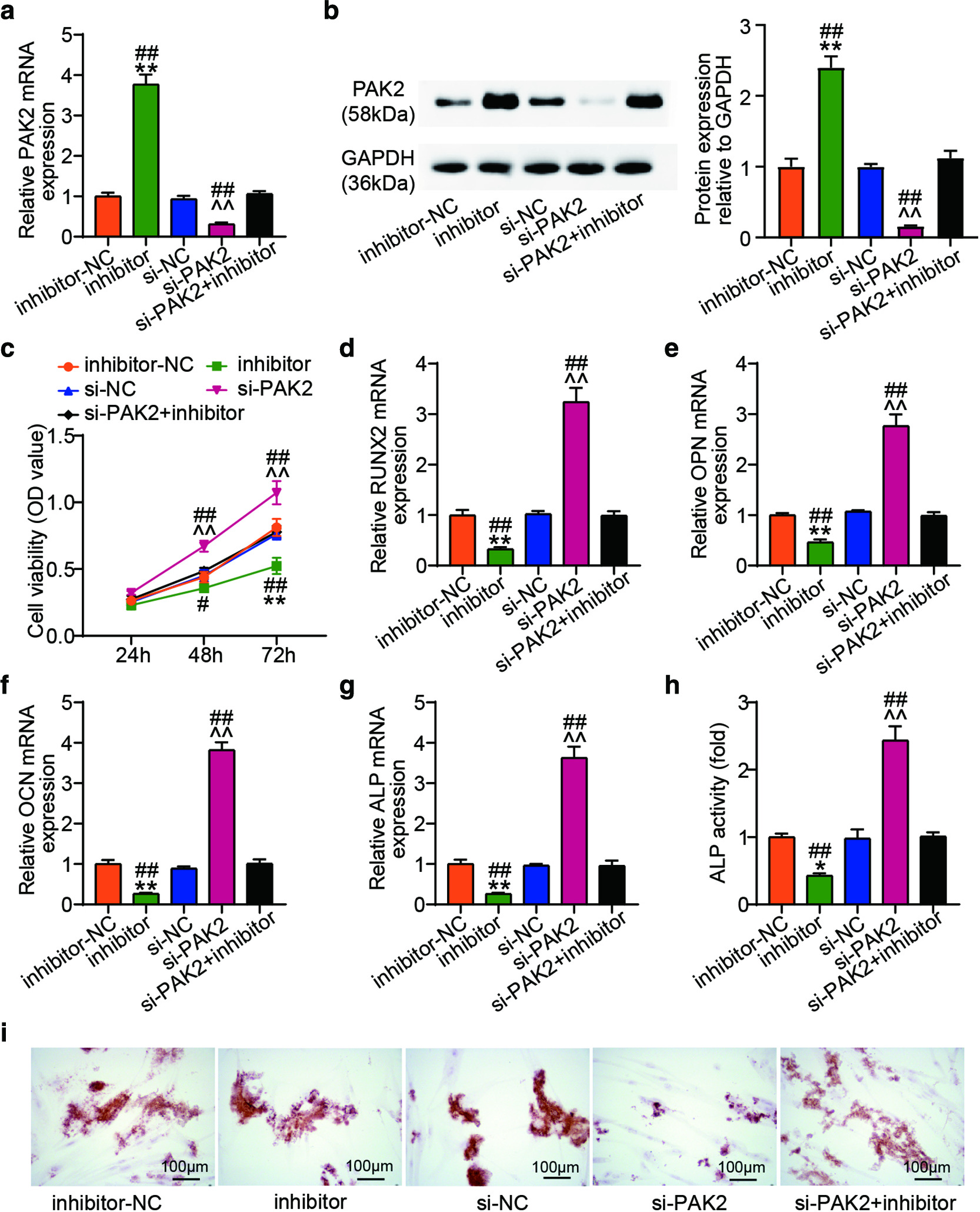 Fig. 6 
            MicroRNA (miR)-126-5p regulated osteoblast differentiation of human bone marrow-derived mesenchymal stem cells (hBMSCs) by targeting group I Pak family member p21-activated kinase 2 (PAK2). hBMSCs were co-transfected hBMSCs with inhibitor-NC, negative control (si-NC), miR-126-5p inhibitor (inhibitor), and si-PAK2 or si-PAK2 + miR-126-5p inhibitor (si-PAK2 + inhibitor). a) and b) PAK expression was measured by a) quantitative real-time polymerase chain reaction (qRT-PCR) and b) western blot. c) Cell proliferation of hBMSCs was measured by Cell Counting Kit-8 (CCK-8) assay. d) to g) The expression level of osteogenesis-related genes (Runt-related transcription factor 2 (RUNX2), osteopontin (OPN), osteocalcin (OCN), and alkaline phosphatase (ALP)) detected by qRT-PCR. h) ALP activity was detected by ALP staining and quantification. i) Calcium deposits in hBMSCs were detected by Alizarin red staining. The data represent the mean (standard deviation). *p < 0.05, **p < 0.001 compared with inhibitor-NC, ^^p < 0.001 compared with si-NC, #p < 0.05, ##p < 0.001 compared with si-PAK2+ inhibitor; calculated using one-way analysis of variance. GAPDH, glyceraldehyde 3-phosphate dehydrogenase; mRNA, messenger RNA; OD, optical density.
          